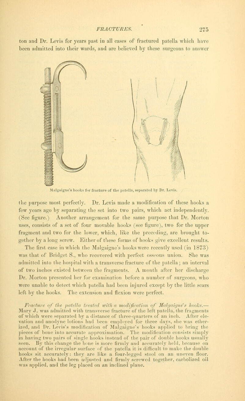 ton and Dr. Levis for years past in all cases of fractured patella which have been admitted into their wards, and are believed by these surgeons to answer Malgaigne's hooks for fracture of the patella, separated by Dr. Levis. / the purpose most perfectly. Dr. Levis made a modification of these hooks a few years ago by separating the set into two pairs, which act independently. (See figure.) Another arrangement for the same purpose that Dr. Morton uses, consists of a set of four movable hooks (see figure), two for the upper fragment and two for the lower, which, like the preceding, are brought to- gether by a long screw. Either of these forms of hooks give excellent results. The first case in which the Malgaigne's hooks were recently used (in 1873) was that of Bridget S., who recovered with perfect osseous union. She was admitted into the hospital with a transverse fracture of the patella ; an interval of two inches existed between the fragments. A month after her discharge Dr. Morton presented her for examination before a number of surgeons, who were unable to detect which patella had been injured except by the little scars left by the hooks. The extension and flexion were perfect. Fracture of the patella treated with a modification of Malgaigne's hooks.— Mary J. was admitted with transverse fracture of the left patella, the fragments of which were separated by a distance of three-quarters of an inch. After ele- vation and anodyne lotions had been employed for three days, she was ether- ized, and Dr. Levis's modification of Malgaigne's hooks applied to bring the pieces of bone into accurate approximation. The modification consists simply in having two pairs of single hooks instead of the pair of double hooks usually seen. By this change the bone is more firmly and accurately held, because on account of the irregular surface of the patella it is difficult to make the double hooks sit accurately: they are like a four-legged stool on an uneven floor. After the hooks had been adjusted and firmly screwed together, carbolized oil was applied, and the leg placed on an inclined plane.