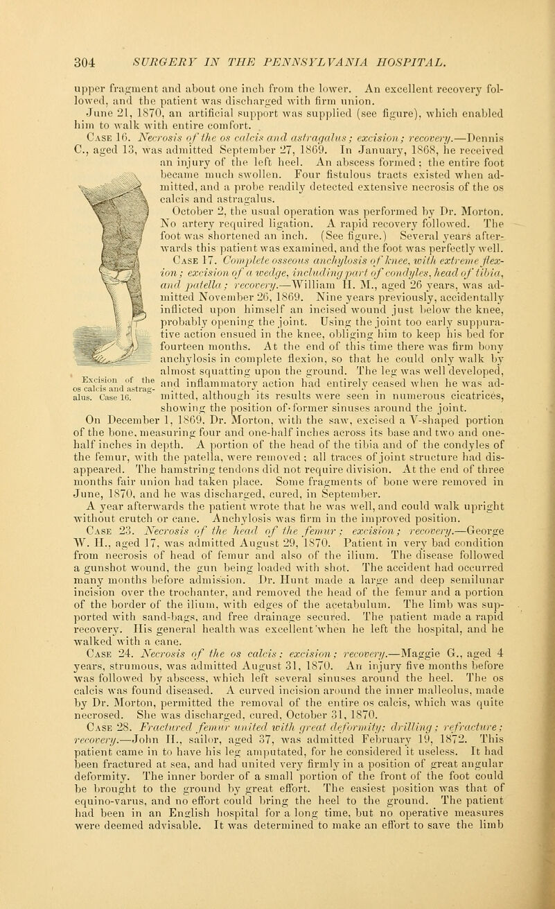 upper fragment and about one inch from the lower. An excellent recovery fol- lowed, and the patient was discharged with firm union. June 21, 1870, an artificial support was supplied (see figure), which enabled him to walk with entire comfort. Case 16. Necrosis of the os calcis and astragalus; excision; recovery.—Dennis C, aged 13, was admitted September 27, 1869. In January, 1868, he received an injury of the left heel. An abscess formed ; the entire foot became much swollen. Four fistulous tracts existed when ad- mitted, and a probe readily detected extensive necrosis of the os calcis and astragalus. October 2, the usual operation was performed by Dr. Morton. No artery required ligation. A rapid recovery followed. The foot was shortened fin inch. (See figure.) Several years after^ wards this patient was examined, and the foot was perfectly well. Case 17. Complete osseous anchylosis of knee, with extreme flex- ion ; excision of a wedge, including part of condyles, head of tibia, and patella ; recovery.—William H. M., aged 26 years, was ad- mitted November 26, 1869. Nine years previously, accidentally inflicted upon himself an incised wound just below the knee, probably opening the joint. Using the joint too early suppnra- - i\ L tive action ensued in tin' knee, obliging him to keep his bed for -;.■■■. ' fourteen months. At the end of this time there was firm bony Mg^^^ggV; | anchylosis in complete flexion, so that he could only walk by almost squatting upon the ground. The leg was well developed, Excision of the an(j inflammatory action had entirely ceased when he was ad- os calcis and astrag- . . . , , J. . •> . . . alus. Case 16. mitted, although its results were seen in numerous cicatrices, showing the position of-former sinuses around the joint. On December 1, 1869. Dr. Morton, with the saw, excised a V-shaped portion of the bone, measuring four and one-half inches across its base and two and one- half inches in depth. A portion of the head of the tibia and of the condyles of the femur, with the patella, were removed ; all traces of joint structure had dis- appeared. The hamstring tendons did not require division. At the end of three months fair union had taken place. Some fragments of bone were removed in June, 1870, and he was discharged, cured, in September. A year afterwards the patient wrote that he was well, and could walk upright without crutch or cane. Anchylosis was firm in the improved position. Case 23. Necrosis of the head of the femur; excision; recovery.—George W. II., aged 17, was admitted August 29, 1870. Patient in very bad condition from necrosis of head of femur and also of the ilium. The disease followed a gunshot wound, the gun being loaded with shot. The accident had occurred many months before admission. Dr. Hunt made a large and deep semilunar incision over the trochanter, and removed the head of the femur and a portion of the border of the ilium, with edges of the acetabulum. The limb was sup- ported with sand-bags, and free drainage secured. The patient made a rapid recovery. His general health was excellent'when he left the hospital, and he walked with a cane. Case 24. Necrosis of the os calcis; excision; recovery.—Maggie G., aged 4 years, strumous, was admitted August 31, 1870. An injury five months before was followed by abscess, which left several sinuses around the heel. The os calcis was found diseased. A curved incision around the inner malleolus, made by Dr. Morton, permitted the removal of the entire os calcis, which was quite necrosed. She was discharged, cured, October 31, 1870. Case 28. Fractured femur united with great deformity; drilling; refracture; recovery.—John II., sailor, aged 37, was admitted February 19, 1872. This patient came in to have his leg amputated, for he considered it useless. It had been fractured at sea, and had united very firmly in a position of great angular deformity. The inner border of a small portion of the front of the foot could be brought to the ground by great effort. The easiest position was that of equino-varus, and no effort could bring the heel to the ground. The patient had been in an English hospital for a long time, but no operative measures were deemed advisable. It was determined to make an effort to save the limb