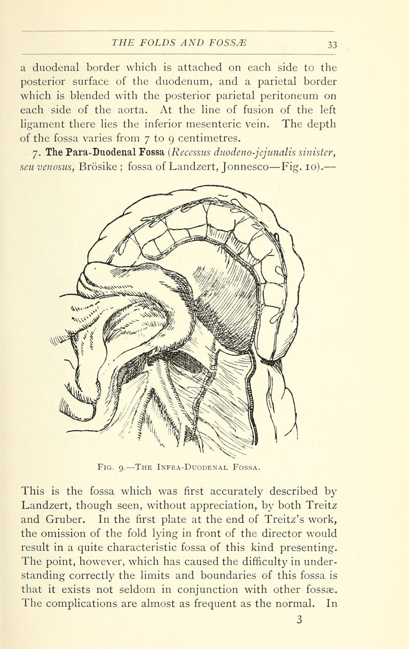 a duodenal border which is attached on each side to the posterior surface of the duodenum, and a parietal border which is blended with the posterior parietal peritoneum on each side of the aorta. At the line of fusion of the left ligament there lies the inferior mesenteric vein. The depth of the fossa varies from 7 to 9 centimetres. 7. The Para-Duodenal Fossa {Reccssus dnodeno-jejunalis sinister, sen venosus, Brosike ; fossa of Landzert, Jonnesco—Fig. 10).— Fig. 9.—The Infra-Duodenal Fossa. This is the fossa which was first accurately described by Landzert, though seen, without appreciation, by both Treitz and Gruber. In the first plate at the end of Treitz's work, the omission of the fold lying in front of the director would result in a quite characteristic fossa of this kind presenting. The point, however, which has caused the difficulty in under- standing correctly the limits and boundaries of this fossa is that it exists not seldom in conjunction with other fossae. The complications are almost as frequent as the normal. In 3