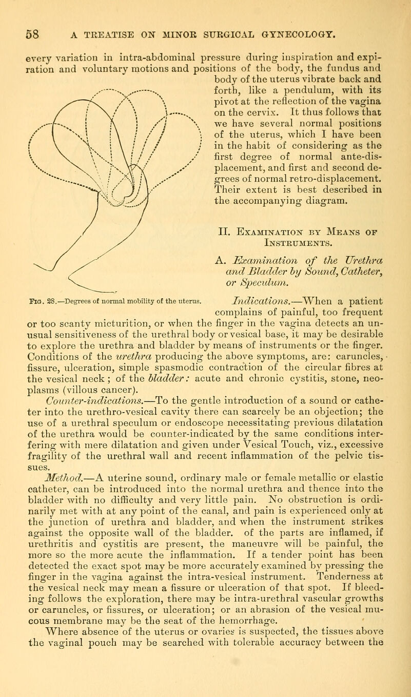 every variation in intra-abdominal pressure during inspiration and expi- ration and voluntary motions and positions of the body, the fundus and body of the uterus vibrate back and forth, like a pendulum, with its pivot at the reflection of the vagina V , on the cervix. It thus follows that j \ we have several normal positions • of the uterus, which I have been / in the habit of considering as the first degree of normal ante-dis- /'' placement, and first and second de- .-•' grees of normal retro-displacement. Their extent is best described in the accompanying diagram. II. Examination by Means of Instruments. A. Examination of the Urethra and Bladder by Sound, Catheter, or Speculum. Fig. 28.—Degrees of normal mobility of the uterus. Indications. When a patient complains of painful, too frequent or too scanty micturition, or when the finger in the vagina detects an un- usual sensitiveness of the urethral body or vesical base, it may be desirable to explore the urethra and bladder by means of instruments or the finger. Conditions of the urethra producing the above symptoms, are: caruncles, fissure, ulceration, simple spasmodic contraction of the circular fibres at the vesical neck ; of the bladder: acute and chronic cystitis, stone, neo- plasms (villous cancer). Counter-indications.—To the gentle introduction of a sound or cathe- ter into the urethro-vesical cavity there can scarcely be an objection; the use of a urethral speculum or endoscope necessitating previous dilatation of the urethra would be counter-indicated by the same conditions inter- fering with mere dilatation and given under Vesical Touch, viz., excessive fragility of the urethral wall and recent inflammation of the pelvic tis- sues. Method.—A uterine sound, ordinary male or female metallic or elastic catheter, can be introduced into the normal urethra and thence into the bladder with no difficulty and very little pain. No obstruction is ordi- narily met with at any point of the canal, and pain is experienced only at the junction of urethra and bladder, and when the instrument strikes against the opposite wall of the bladder, of the parts are inflamed, if urethritis and cystitis are present, the maneuvre will be painful, the more so the more acute the inflammation. If a tender point has been detected the exact spot may be more accurately examined by pressing the finger in the vagina against the intra-vesical instrument. Tenderness at the vesical neck may mean a fissure or ulceration of that spot. If bleed- ing follows the exploration, there may be intra-urethral vascular growths or caruncles, or fissures, or ulceration; or an abrasion of the vesical mu- cous membrane may be the seat of the hemorrhage. Where absence of the uterus or ovaries is suspected, the tissues above the vaginal pouch may be searched with tolerable accuracy between the