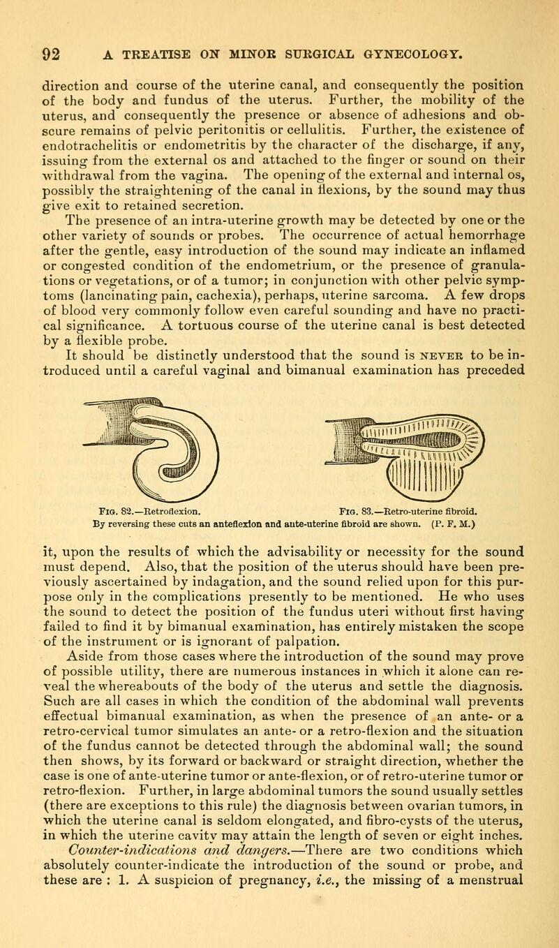 direction and course of the uterine canal, and consequently the position of the body and fundus of the uterus. Further, the mobility of the uterus, and consequently the presence or absence of adhesions and ob- scure remains of pelvic peritonitis or cellulitis. Further, the existence of endotrachelitis or endometritis by the character of the discharge, if any, issuing from the external os and attached to the finger or sound on their withdrawal from the vagina. The opening of the external and internal os, possibly the straightening of the canal in liexions, by the sound may thus give exit to retained secretion. The presence of an intra-uterine growth may be detected by one or the other variety of sounds or probes. The occurrence of actual hemorrhage after the gentle, easy introduction of the sound may indicate an inflamed or congested condition of the endometrium, or the presence of granula- tions or vegetations, or of a tumor; in conjunction with other pelvic symp- toms (lancinating pain, cachexia), perhaps, uterine sarcoma. A few drops of blood very commonly follow even careful sounding and have no practi- cal significance. A tortuous course of the uterine canal is best detected by a flexible probe. It should be distinctly understood that the sound is never to be in- troduced until a careful vaginal and bimanual examination has preceded Fig. 82.—Retroflexion. Fig. 83.—Retro-uterine fibroid. By reversing these cuts an anteflexion and ante-uterine fibroid are shown. (P. F. M.) it, upon the results of which the advisability or necessity for the sound must depend. Also, that the position of the uterus should have been pre- viously ascertained by indagation, and the sound relied upon for this pur- pose only in the complications presently to be mentioned. He who uses the sound to detect the position of the fundus uteri without first having failed to find it by bimanual examination, has entirely mistaken the scope of the instrument or is ignorant of palpation. Aside from those cases where the introduction of the sound may prove of possible utility, there are numerous instances in which it alone can re- veal the whereabouts of the body of the uterus and settle the diagnosis. Such are all cases in which the condition of the abdominal wall prevents effectual bimanual examination, as when the presence of an ante- or a retro-cervical tumor simulates an ante- or a retro-flexion and the situation of the fundus cannot be detected through the abdominal wall; the sound then shows, by its forward or backward or straight direction, whether the case is one of ante-uterine tumor or ante-flexion, or of retro-uterine tumor or retro-flexion. Further, in large abdominal tumors the sound usually settles (there are exceptions to this rule) the diagnosis between ovarian tumors, in which the uterine canal is seldom elongated, and fibro-cysts of the uterus, in which the uterine cavity may attain the length of seven or eight inches. Counter-indications a?id dangers.—There are two conditions which absolutely counter-indicate the introduction of the sound or probe, and these are : 1. A suspicion of pregnancy, i.e., the missing of a menstrual