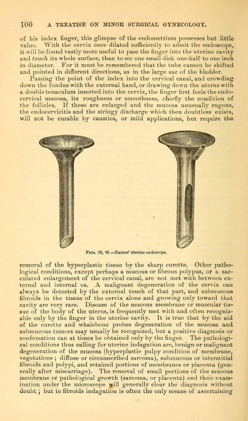 of his index finger, this glimpse of the endometrium possesses but little value. With the cervix once dilated sufficiently to admit the endoscope, it will be found vastly more useful to pass the finger into the uterine cavity and touch its whole surface, than to see one small disk one-half to one inch in diameter. For it must be remembered that the tube cannot be shifted and pointed in different directions, as in the large sac of the bladder. Passing the point of the index into the cervical canal, and crowding down the fundus with the external hand, or drawing down the uterus with a double tenaculum inserted into the cervix, the finger first feels the endo- cervical mucosa, its roughness or smoothness, chiefly the condition of the follicles. If these are enlarged and the mucosa unusually rugous, the endocervicitis and the stringy discharge which then doubtless exists, will not be curable by caustics, or mild applications, but require the Pigs. 89, 90.—Barnes' nterine endoscope. removal of the hyperplastic tissue by the sharp curette. Other patho- logical conditions, except perhaps a mucous or fibrous polypus, or a sac- culated enlargement of the cervical canal, are not met with between ex- ternal and internal os. A malignant degeneration of the cervix can always be detected by the external touch of that part, and submucous fibroids in the tissue of the cervix alone and growing only toward that cavity are very rare. Disease of the mucous membrane or muscular tis- sue of the body of the uterus, is frequently met with and often recogniz- able only by the finger in the uterine cavity. It is true that by the aid of the curette and whalebone probes degeneration of the mucosa and submucous tumors may usually be recognized, but a positive diagnosis or confirmation can at times be obtained only by the finger. The pathologi- cal conditions thus calling for uterine indagation are, benign or malignant degeneration of the mucosa (hyperplastic pulpy condition of membrane, vegetations ; diffuse or circumscribed sarcoma), submucous or interstitial fibroids and polypi, and retained portions of membranes or placenta (gen- erally after miscarriage). The removal of small portions of the mucous membrane or pathological growth (sarcoma, or placenta) and their exam- ination under the microscope will generally clear the diagnosis without doubt ; but in fibroids indagation is often the only means of ascertaining