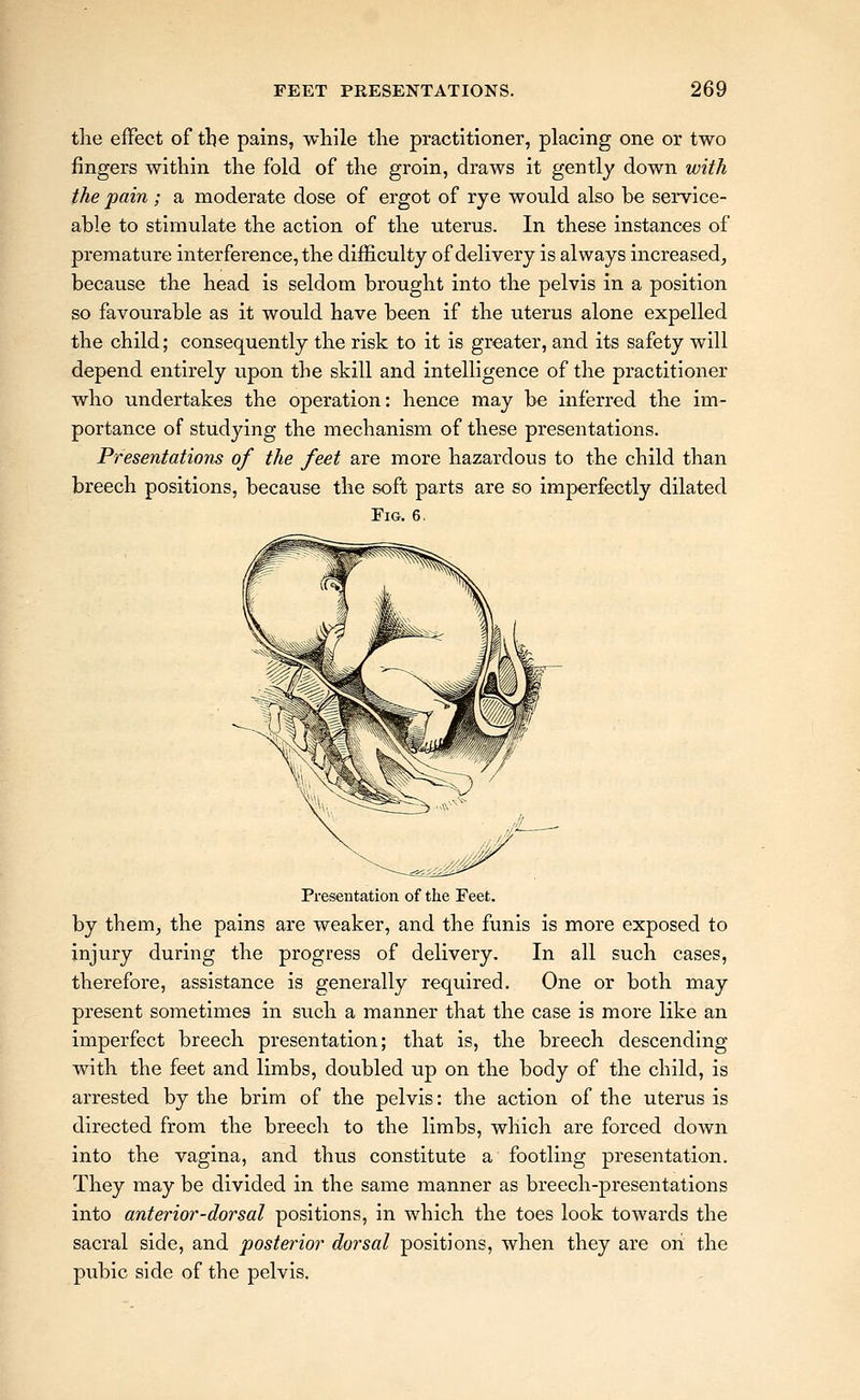tlie efFect of the pains, while the practitioner, placing one or two fingers within the fold of the groin, draws it gently down with the pain ; a moderate dose of ergot of rye would also be service- able to stimulate the action of the uterus. In these instances of premature interference, the difficulty of delivery is always increased^ because the head is seldom brought into the pelvis in a position so favourable as it would have been if the uterus alone expelled the child; consequently the risk to it is greater, and its safety will depend entirely upon the skill and intelligence of the practitioner who undertakes the operation: hence may be inferred the im- portance of studying the mechanism of these presentations. Presentations of the feet are more hazardous to the child than breech positions, because the soft parts are so imperfectly dilated Fig. 6. Presentation of the Feet, by them, the pains are weaker, and the funis is more exposed to injury during the progress of delivery. In all such cases, therefore, assistance is generally required. One or both may present sometimes in such a manner that the case is more like an imperfect breech presentation; that is, the breech descending with the feet and limbs, doubled up on the body of the child, is arrested by the brim of the pelvis: tlie action of the uterus is directed from the breech to the limbs, which are forced down into the vagina, and thus constitute a footling presentation. They may be divided in the same manner as breech-presentations into anterior-dorsal positions, in which the toes look towards the sacral side, and posterior dorsal positions, when they are on the pvibic side of the pelvis.