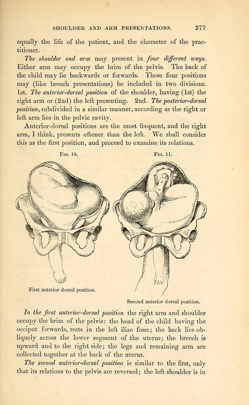 equally the life of the patient, and the character of the prac- titioner. The shoulder and arm may present in four different ways. Either arm may occupy the brim of the pelvis. The back of the child may lie backwards or forwards. These four positions may (like breech presentations) be included in two divisions. 1st. The anterior-dorsal position of the shoulder, having (1st) the right arm or (2nd) the left presenting. 2nd. The posterior-dorsal position, subdivided in a similar manner, according as the right or left arm lies in the pelvic cavity. Anterior-dorsal positions are the most frequent, and the right arm, I think, presents oftener than the left. We shall consider this as the first position, and proceed to examine its relations. Fig. 10. Fig. 11. First anterior dorsal position Second anterior dorsal position. In the first anterior-dorsal position the right arm and shoulder occupy the brim of the pelvis: the head of the child having the occiput forwards, rests in the left iliac fossa; the back lies ob- liquely across the lower segment of the uterus; the breecli is upward and to the right side; the legs and remaining arm are collected together at the back of the uterus. The second anterior-dorsal position is similar to the first, only that its relations to the pelvis are reversed; the left shoulder is in