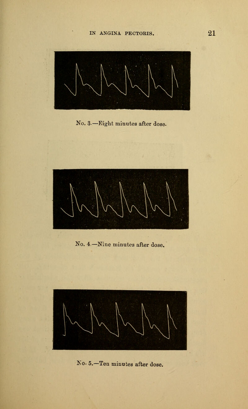 No. 3-—Eight minutes after dose. No. 4.—Nine minutes after dose.