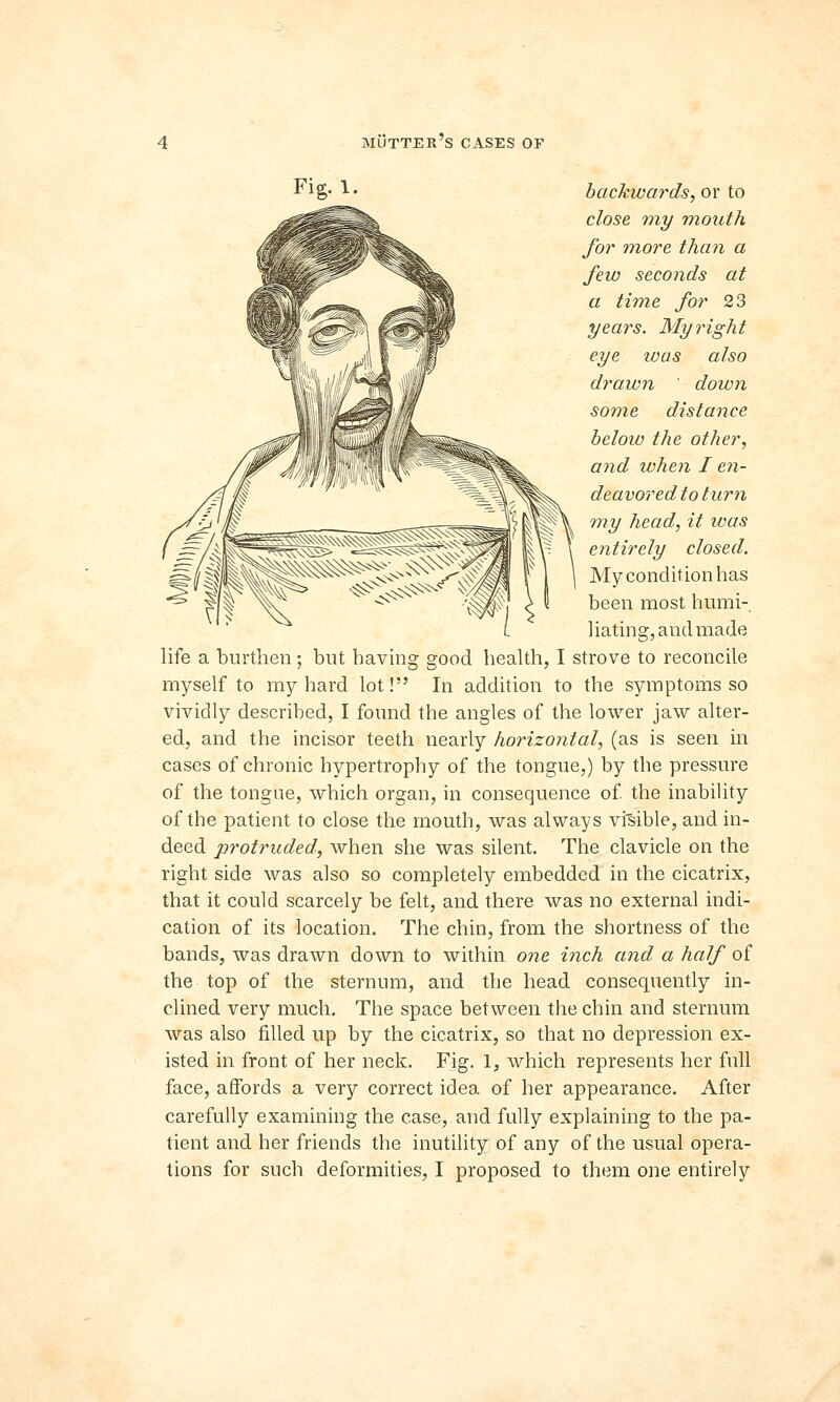 Fig* !• backwards, or to close my mouth for more than a few seconds at a time for 23 years. My right eye ivas also drawn down some distance below the other, and when I en- deavored to turn my head, it ivas entirely closed. My condition has been most humi- liating, and made life a burthen; but having good health, I strove to reconcile myself to my hard lot! In addition to the symptoms so vividly described, I found the angles of the lower jaw alter- ed, and the incisor teeth nearly horizontal, (as is seen in cases of chronic hypertrophy of the tongue,) by the pressure of the tongue, which organ, in consequence of. the inability of the patient to close the mouth, was always visible, and in- deed protruded, when she was silent. The clavicle on the right side was also so completely embedded in the cicatrix, that it could scarcely be felt, and there was no external indi- cation of its location. The chin, from the shortness of the bands, was drawn down to within one inch and a half of the top of the sternum, and the head consequently in- clined very much. The space between the chin and sternum was also filled up by the cicatrix, so that no depression ex- isted in front of her neck. Fig. 1, which represents her full face, affords a very correct idea of her appearance. After carefully examining the case, and fully explaining to the pa- tient and her friends the inutility of any of the usual opera- tions for such deformities, I proposed to them one entirely