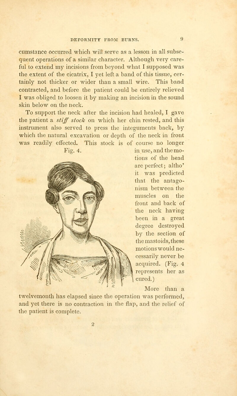 cumstance occurred which will serve as a lesson in all subse- quent operations of a similar character. Although very care- ful to extend my incisions from beyond what I supposed was the extent of the cicatrix, I yet left a band of this tissue, cer- tainly not thicker or wider than a small wire. This band contracted, and before the patient could be entirely relieved I was obliged to loosen it by making an incision in the sound skin below on the neck. To support the neck after the incision had healed, I gave the patient a stiff stock on which her chin rested, and this instrument also served to press the integuments back, by which the natural excavation or depth of the neck in front was readily effected. This stock is of course no longer Fig. 4. in use, and the mo- tions of the head are perfect; altho' it was predicted that the antago- nism between the muscles on the front and back of the neck having been in a great degree destroyed by the section of the mastoids, these motions would ne- cessarily never be acquired. (Fig. 4 represents her as cured.) More than a twelvemonth has elapsed since the operation was performed, and yet there is no contraction in the flap, and the relief of the patient is complete.