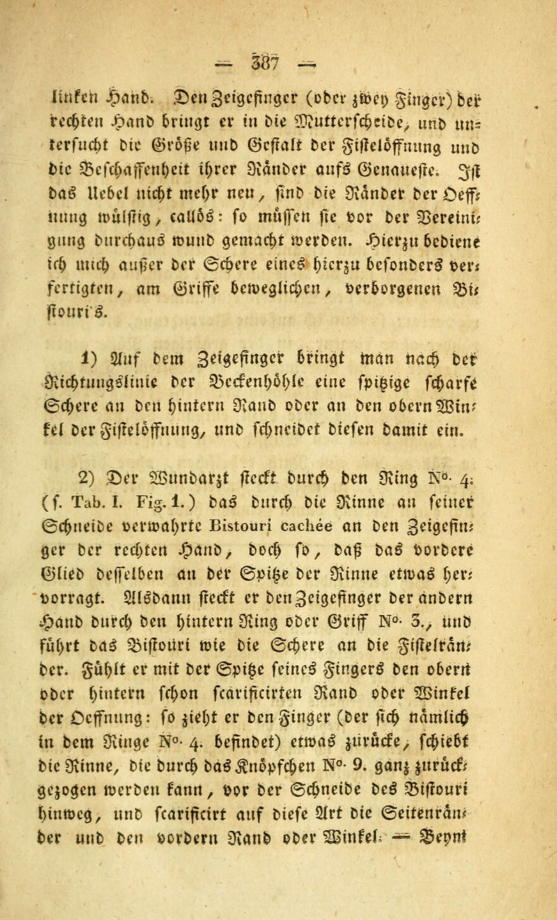 Itnfch Jf)ahb. £en Sctgeftngcr (ober §&et) ginger) ber teerten Jpanb bringt er in bte S!ftuttcrfc£ei&e> unt> tMs terfucl>t Die ©rojse uub ©cfralt ber gtfleloffntmg unb bte S3cfc^ajfcnf>cit iljrer Bidnber aufß ©cnattefte. 3fl baß Webet uicfyt md)V neu, finb bie SKdnber berCeff* uung nwlfltg, caU6£: fo muffen Jte 4>or ber Vereint; gung bttrebauä mutib gemacht merbeu. Jg>tcrju bebiene tcb mtcb außer ber ©c^ere einc£ fjier$u befonberS t>er* fertigten, am griffe beweglichen, verborgenen f&U jbürt'ä. 1) 2Iuf bem äetgeftnger bringt inän iiacb bet Öiicbtuugsiitue ber 55ccfen()6f)(e eine fpüjige f$arf£ ©cbere an ben ^intern 9vaub ober an ben obcrnSQSuu fei bergiftelotfuung, unb febnetbet biefen bamtt ein. 2) £)er 2öunbar$t |?ecft bureb ben Oitng Nb- 4; (f. Tab. I. Fig. 1.) ba3 bnvcf) bic Oitnne an feiner ©cfjneibe vertoabrtc Bistouri cachee an ben Setgefm* ger ber rechten %anb, boeb fo, ba$ baß Vorbcre ©Heb beffelben an bet <Spt£e ber kirnte etföaß l)W vorragt. Süöbänn fteeft er ben 3etgeftnger beränbern %>anb bureb ben ^intern Oting ober ©riff Nö- 3V unb futyrt baß £M)Ioüri tt>te bte ©c&cre an bte giflefraw ber. gubft er mit ber ©pi£e feinet ginget ben obent ober ^intern febon feärifteirfen Outnb ober SBinfel ber Ccffnung: fo $tel)t er ben ginger (ber ftcb ndmlicß in bem Svinge N°- 4. beftnbet) ermaS uiruefe, fc^iebf bic Üiinne, bte bureb bä$$nö>fc&ett N°- 9. gän$ $urucfr gebogen werben fann, vor ber ©ebneibe bei &tffourt btnmcg, unb feariffetrt auf biefe 2Irt bie ©ettenrän* ber unb ben vorbern 3^anb ober SBtnfef; — $&eyn\