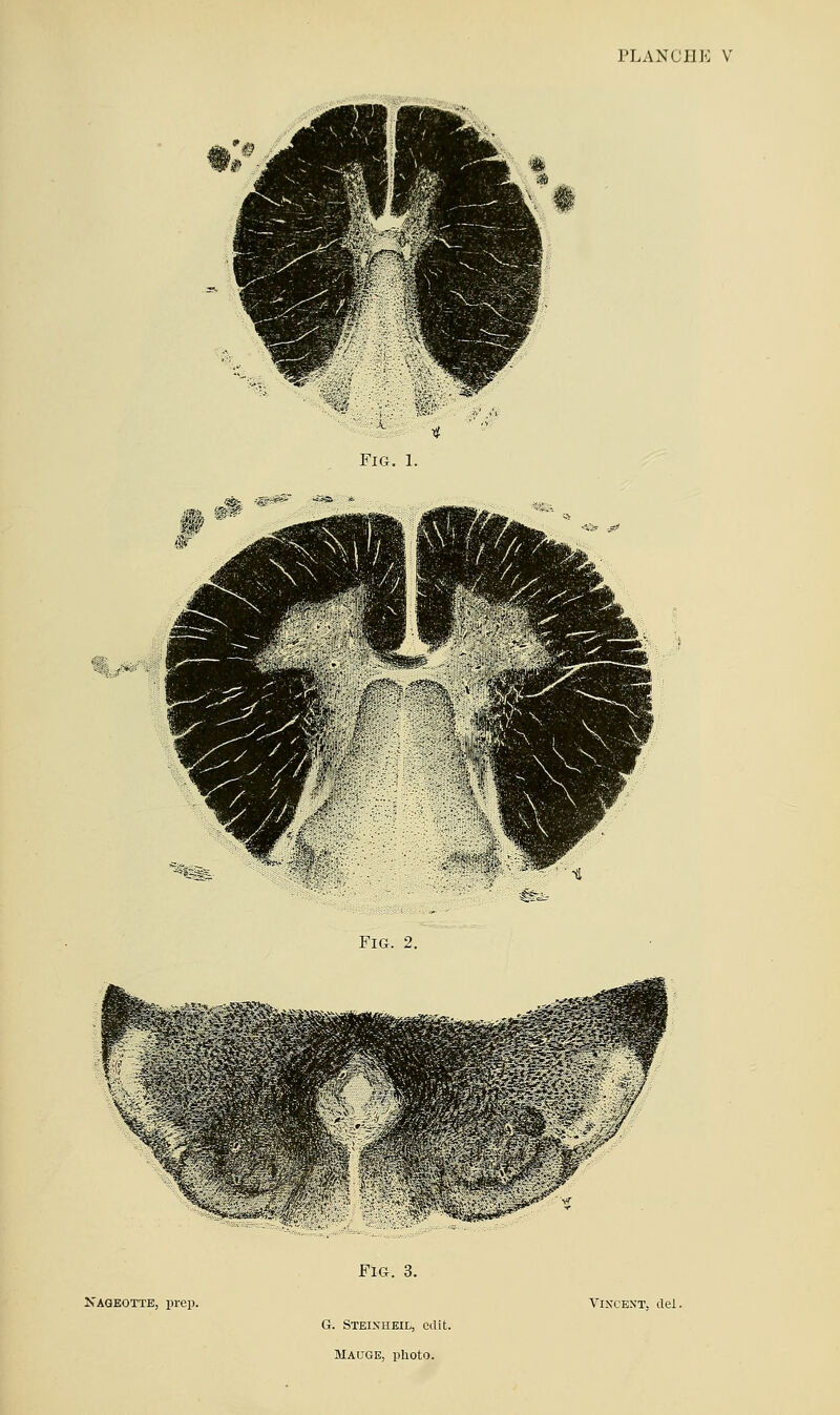 FiG. 1. FiG. 2. ï FlG. 3.