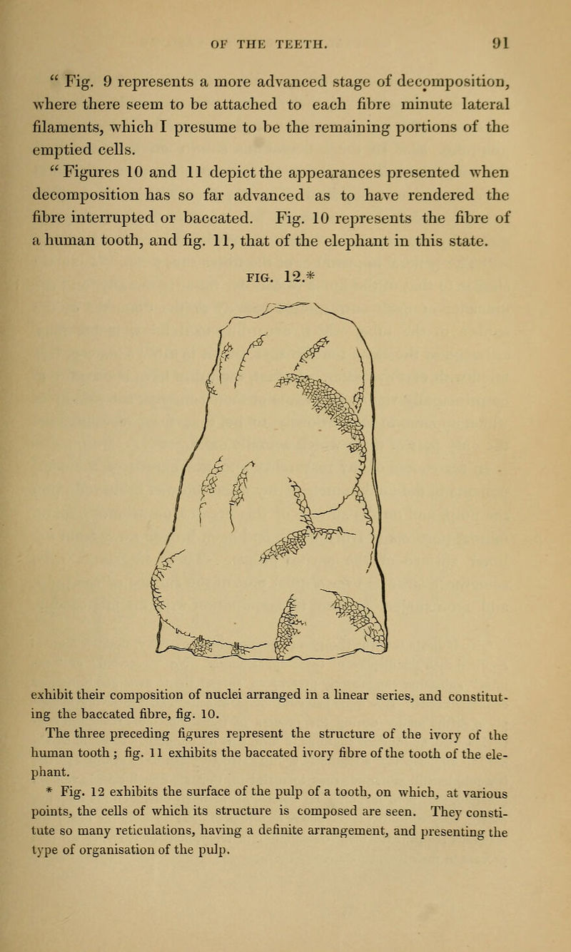  Fig. 9 represents a more advanced stage of decomposition, where there seem to be attached to each fibre minute lateral filaments, which I presume to be the remaining portions of the emptied cells. Figures 10 and 11 depict the appearances presented when decomposition has so far advanced as to have rendered the fibre interrupted or baccated. Fig. 10 represents the fibre of a human tooth, and fig. 11, that of the elephant in this state. fig. 12* exhibit their composition of nuclei arranged in a linear series, and constitut- ing the baccated fibre, fig. 10. The three preceding figures represent the structure of the ivory of the human tooth ; fig. 11 exhibits the baccated ivory fibre of the tooth of the ele- phant. * Fig. 12 exhibits the surface of the pulp of a tooth, on which, at various points, the cells of which its structure is composed are seen. They consti- tute so many reticulations, having a definite arrangement, and presenting the type of organisation of the pulp.