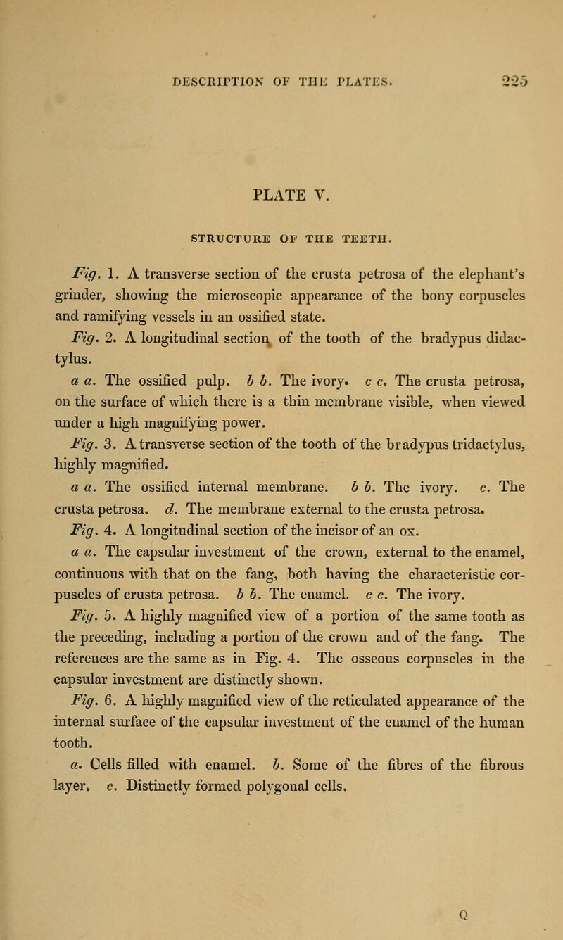 PLATE V. STRUCTURE OF THE TEETH. Fig. 1. A transverse section of the crusta petrosa of the elephant's grinder, showing the microscopic appearance of the bony corpuscles and ramifying vessels in an ossified state. Fig. 2. A longitudinal section, of the tooth of the bradypus didac- tylus. a a. The ossified pulp, b b. The ivory, c c. The crusta petrosa, on the surface of which there is a thin membrane visible, when viewed under a high magnifying power. Fig. 3. A transverse section of the tooth of the bradypus tridactylus, highly magnified. a a. The ossified internal membrane. b b. The ivory. c. The crusta petrosa. d. The membrane external to the crusta petrosa. Fig. 4. A longitudinal section of the incisor of an ox. a a. The capsular investment of the crown, external to the enamel, continuous with that on the fang, both having the characteristic cor- puscles of crusta petrosa. b b. The enamel, c c. The ivory. Fig. 5. A highly magnified view of a portion of the same tooth as the preceding, including a portion of the crown and of the fang. The references are the same as in Fig. 4. The osseous corpuscles in the capsular investment are distinctly shown. Fig. 6. A highly magnified view of the reticulated appearance of the internal surface of the capsular investment of the enamel of the human tooth. a. Cells filled with enamel, b. Some of the fibres of the fibrous layer, c. Distinctly formed polygonal cells.