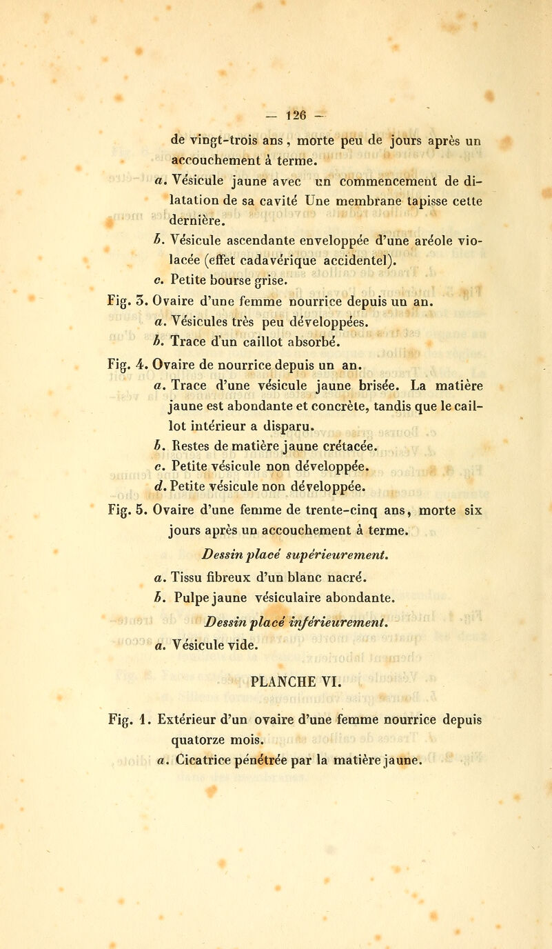 de vingt-trois ans, morte peu de jours après un accouchement à terme. a. Vésicule jaune avec un commencement de di- latation de sa cavité Une membrane tapisse cette dernière. h. Vésicule ascendante enveloppée d'une aréole vio- lacée (effet cadavérique accidentel). c. Petite bourse grise. Fig. 3. Ovaire d'une femme nourrice depuis un an. a. Vésicules très peu développées. b. Trace d'un caillot absorbé. Fig. 4. Ovaire de nourrice depuis un an. a. Trace d'une vésicule jaune brisée. La matière jaune est abondante et concrète, tandis que le cail- lot intérieur a disparu. b. Restes de matière jaune crétacée. c. Petite vésicule non développée. d. Petite vésicule non développée. Fig. 5. Ovaire d'une femme de trente-cinq ans, morte six jours après un accouchement à terme. Dessin placé supérieurement. a. Tissu fibreux d'un blanc nacré. b. Pulpe jaune vésiculaire abondante. Dessin placé inférieurement, a. Vésicule vide. PLANCHE VL Fig. 1. Extérieur d'un ovaire d'une femme nourrice depuis quatorze mois. a. Cicatrice pénétrée par la matière jaune.