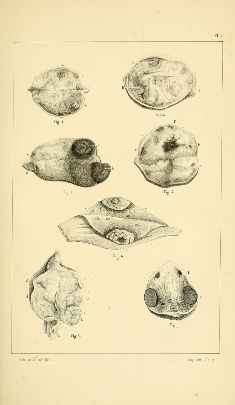 PL3. LithpàT Eiuiic Beau Imp Xitlx à'-^tiis.