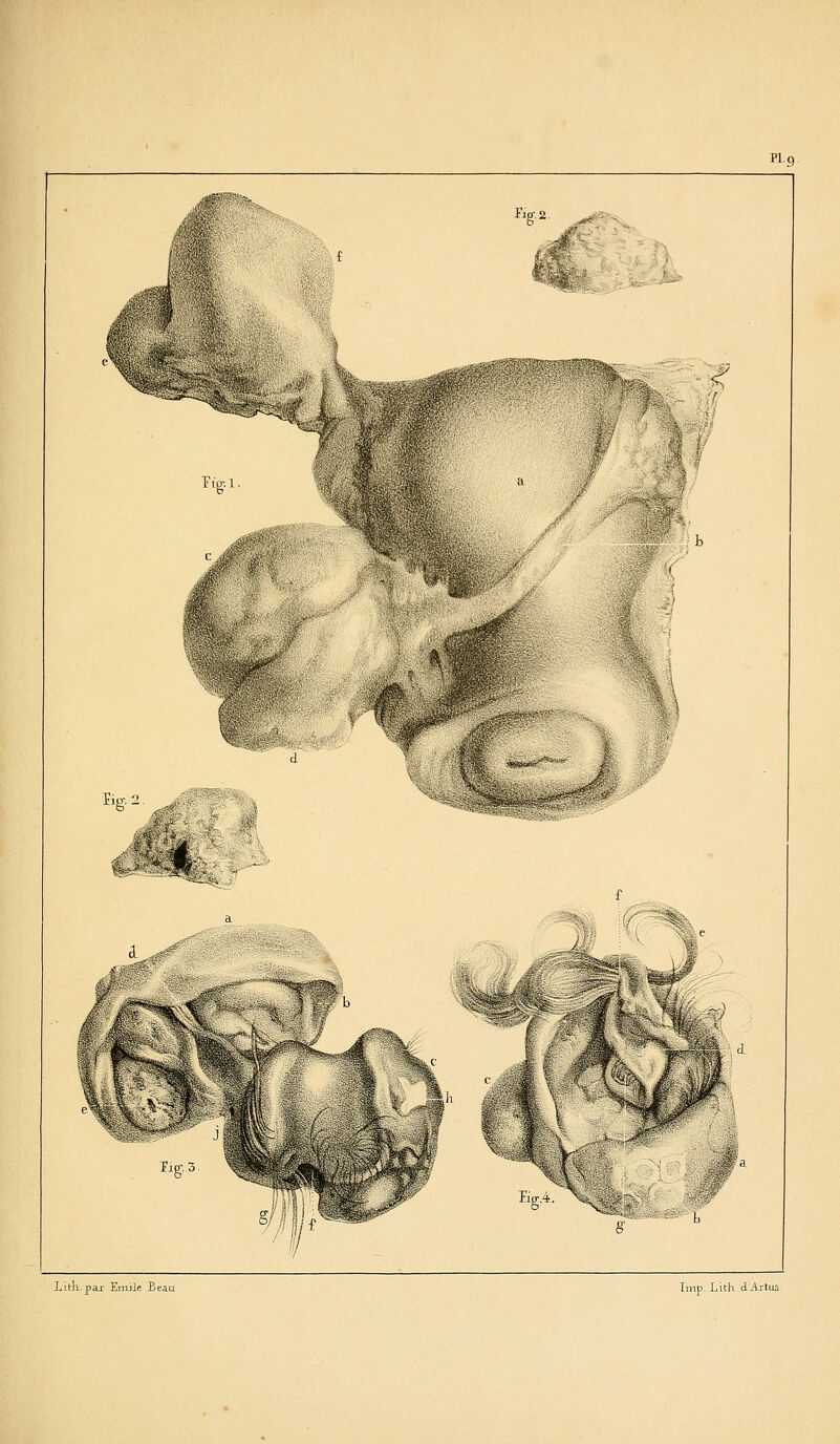 I- '' mA Fia-2 Plg Ticr. 1. -^;. ^^. Tis-2 Tip-.*.