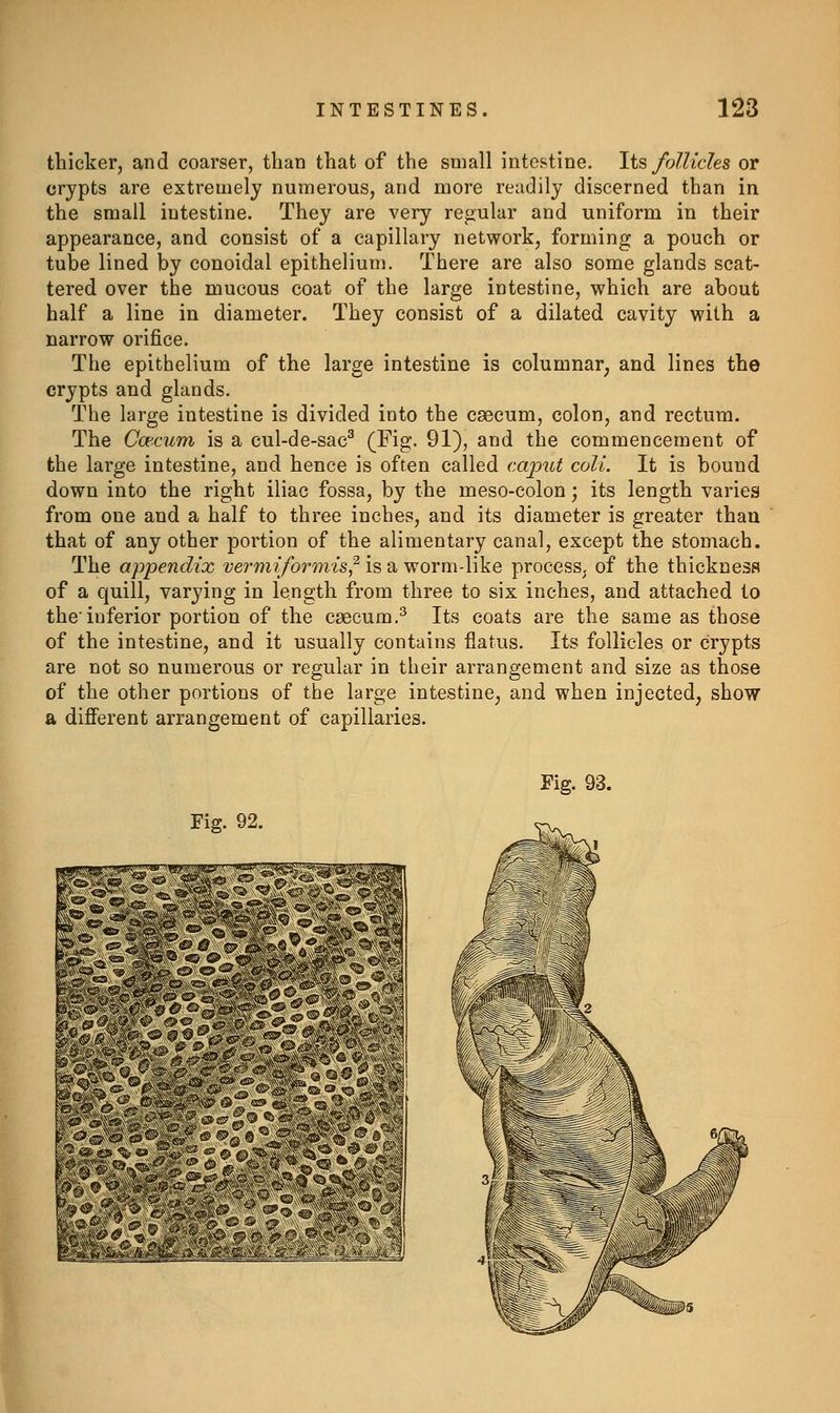 thicker, and coarser, than that of the small intestine. \is follicles or crypts are extremely numerous, and more readily discerned than in the small intestine. They are very regular and uniform in their appearance, and consist of a capillary network, forming a pouch or tube lined by conoidal epithelium. There are also some glands scat- tered over the mucous coat of the large intestine, which are about half a line in diameter. They consist of a dilated cavity with a narrow orifice. The epithelium of the large intestine is columnar^ and lines the crypts and glands. The large intestine is divided into the caecum, colon, and rectum. The Caecum is a cul-de-sac (Fig. 91), and the commencement of the large intestine, and hence is often called caput coll. It is bound down into the right iliac fossa, by the meso-colon; its length varies from one and a half to three inches, and its diameter is greater than that of any other portion of the alimentary canal, except the stomach. The appendix vermiformis,^ is a worm-like procesSj of the thickness of a quill, varying in length from three to six inches, and attached to the'inferior portion of the caecum.^ Its coats are the same as those of the intestine, and it usually contains flatus. Its follicles or crypts are not so numerous or regular in their arrangement and size as those of the other portions of the large intestine^ and when injected, show a different arrangement of capillaries. Fig. 93. Fig. 92. \