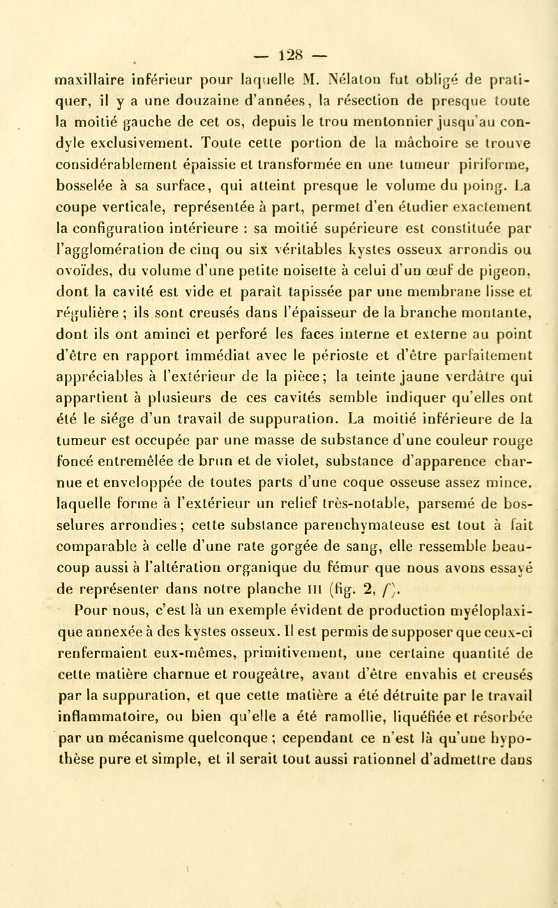 maxillaire inférieur pour laquelle M. ïNélaloii fut obligé de prati- quer, il y a une douzaine d'années, la résection de presque toute la moitié gauche de cet os, depuis le trou mentonnier jusqu'au con- dyle exclusivement. Toute cette portion de la mâchoire se trouve considérablement épaissie et transformée en une tumeur pirifbrme, bosselée à sa surface, qui atteint presque le volume du poing. La coupe verticale, représentée à part, permet d'en étudier exactenjent la configuration intérieure : sa moitié supérieure est constituée par l'agglomération de cinq ou six véritables kystes osseux arrondis ou ovoïdes, du volume d'une petite noisette à celui d'un œuf de pigeon, dont la cavité est vide et paraît tapissée par une membrane lisse et régulière ; ils sont creusés dans l'épaisseur de la branche montante, dont ils ont aminci et perforé les faces interne et externe au point d'être en rapport immédiat avec le périoste et d'être parfaitement appréciables à l'extérieur de la pièce; la teinte jaune verdàtre qui appartient à plusieurs de ces cavités semble indiquer qu'elles ont été le siège d'un travail de suppuration. La moitié inférieure de la tumeur est occupée par une masse de substance d'une couleur rouge foncé entremêlée de brun et de violet, substance d'apparence char- nue et enveloppée de toutes parts d'une coque osseuse assez mince, laquelle forme à l'extérieur un relief très-notable, parsemé de bos- selures arrondies; cette substance parenchymateuse est tout à fait comparable à celle d'une rate gorgée de sang, elle ressemble beau- coup aussi à l'altération organique du fémur que nous avons essayé de représenter dans notre planche m (Pig. 2, f). Pour nous, c'est là un exemple évident de production myéloplaxi- que annexée à des kystes osseux. Il est permis de supposer que ceux-ci renfermaient eux-mêmes, primitivement, une certaine quantité de cette matière charnue et rougeâtre, avant d'être envahis et creusés par la suppuration, et que cette matière a été détruite par le travail inflammatoire, ou bien qu'elle a été ramollie, liquéfiée et résorbée par un mécanisme quelconque ; cependant ce n'est là qu'une hypo- thèse pure et simple, et il serait tout aussi rationnel d'admettre dans