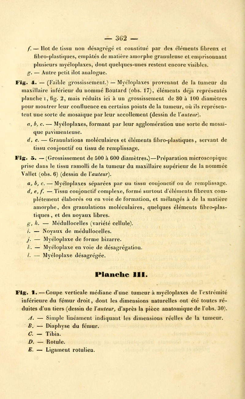 f. — Ilot de tissu non désaffrégé et constitué par des éléments fibreux et fihro-plastiques, empâtés de matière amorphe granuleuse et emprisonnant plusieurs myéloplaxes, dont quelques-unes restent encore visibles. s. — Autre petit ilôt analogue. Fig. 4. — (Faible grossissement.) — Myéloplaxes provenant de la tumeur du maxillaire inférieur du nommé Boutard (obs. 17), éléments déjà représentés planche i, fig. 2, mais réduits ici à un grossissement de 80 à 100 diamètres pour montrer leur confluence en certains points de la tumeur, où ils représen- tent une sorte de mosaïque par leur accollement (dessin de \auteur), a, b, c. — Myéloplaxes, formant par leur agglomération une sorte de mosaï- que pavimenteuse. d, e. — Granulations moléculaires et éléments fibro-plastiques, servant de tissu conjonctif ou tissu de remplissage. Fig. 5. — (Grossissement de 500 à 600 diamètres.)—Préparation microscopique prise dans le tissu ramolli de la tumeur du maxillaire supérieur de la nommée Vallet (obs. 6) (dessin de Vauteur). Oj, bj c. — Myéloplaxes séparées par uu tissu coujouclif ou de remplissage. dj e^ f. —Tissu conjonctif complexe, formé surtout d'éléments fibreux com- plètement élaborés ou en voie de formation, et mélangés à de la matière amorphe, des granulations moléculaires, quelques éléments fibro-plas- tiques , et des noyaux libres. g, h. — Médullocelles (variété cellule). /. — Noyaux de médullocelles. /'. — Myéloplaxe de forme bizarre. /. — Myéloplaxe en voie de désagrégation. /. — Myéloplaxe désagrégée. Planche III. Wig» 1. — Coupe verticale médiane d'une tumeur k myéloplaxes de l'extrémité inférieure du fémur droit, dont les dimensions naturelles ont été toutes ré- duites d'un tiers (dessin de Vauteur, d'après la pièce anatomique de l'obs. 30). y/. — Simple linéament indiquant les dimensions réelles de la tumeur. B. — Diaphyse du fémur. C7. — Tibia. D. — Rotule. E. — Ligament rolulien.