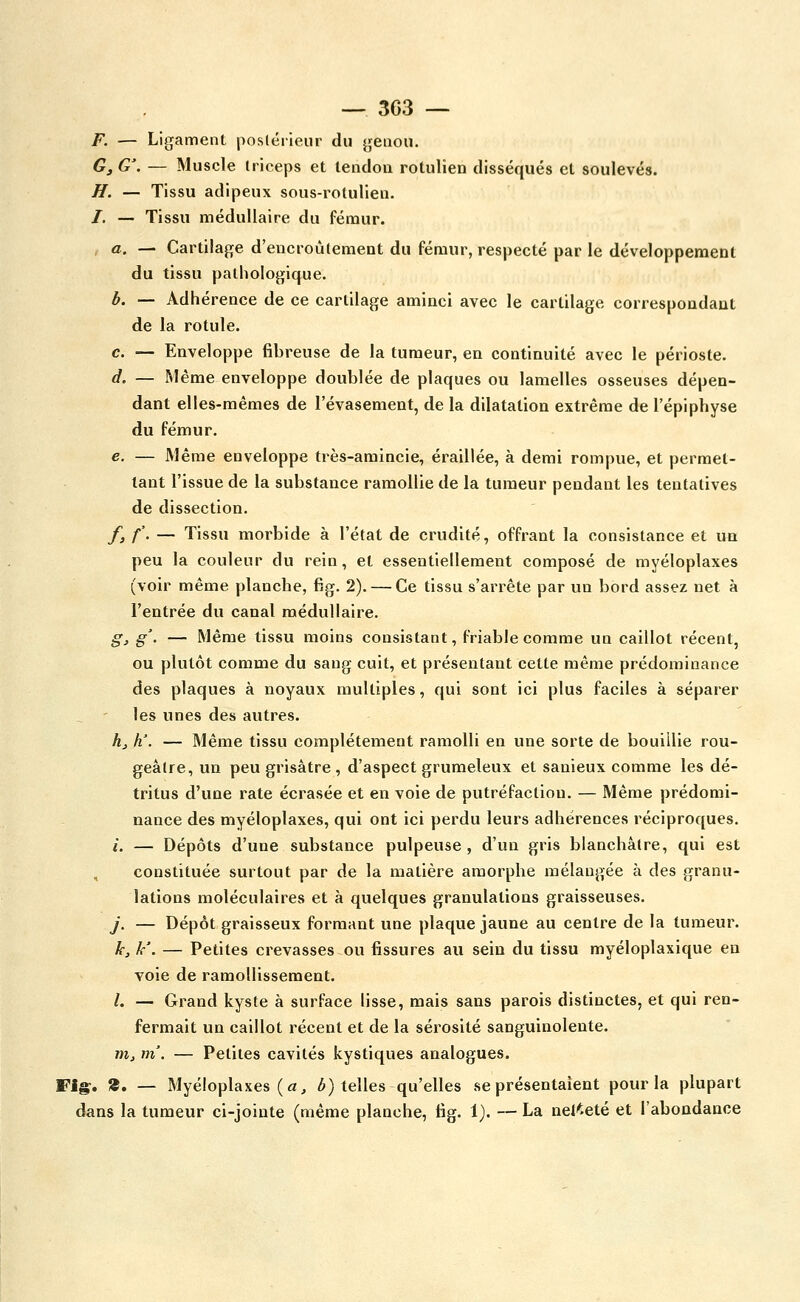 F. — Ligament postérieur du genou. Gj G'. — Muscle triceps et tendon rotulien disséqués et soulevés. H. — Tissu adipeux sous-rotullen. /. — Tissu médullaire du fémur. a. — Cartilage d'encroûtement du fémur, respecté par le développement du tissu pathologique. b. — Adhérence de ce cartilage aminci avec le cartilage correspondant de la rotule. c. — Enveloppe fibreuse de la tumeur, en continuité avec le périoste. d. — Même enveloppe doublée de plaques ou lamelles osseuses dépen- dant elles-mêmes de l'évasement, de la dilatation extrême de l'épiphyse du fémur. e. — Même enveloppe très-amincie, éraillée, à demi rompue, et permet- tant l'issue de la substance ramollie de la tumeur pendant les tentatives de dissection. f. f. — Tissu morbide à l'état de crudité, offrant la consistance et un peu la couleur du rein, et essentiellement composé de myéloplaxes (voir même planche, fig. 2). — Ce tissu s'arrête par un bord assez net à l'entrée du canal médullaire. g. g'. — Même tissu moins consistant, friable comme un caillot récent, ou plutôt comme du sang cuit, et présentant cette même prédominance des plaques à noyaux multiples, qui sont ici plus faciles à séparer les unes des autres. h^ h'. — Même tissu complètement ramolli en une sorte de bouillie rou- geâtre, un peu grisâtre , d'aspect grumeleux et sanieux comme les dé- tritus d'une rate écrasée et en voie de putréfaction. — Même prédomi- nance des myéloplaxes, qui ont ici perdu leurs adhérences réciproques. /, — Dépôts d'une substance pulpeuse , d'un gris blanchâtre, qui est , constituée surtout par de la matière amorphe mélangée à des granu- lations moléculaires et à quelques granulations graisseuses. j. — Dépôt graisseux formant une plaque jaune au centre de la tumeur. k, k\ — Petites crevasses ou fissures au sein du tissu myéloplaxique eu voie de ramollissement. /. — Grand kyste à surface lisse, mais sans parois distinctes, et qui ren- fermait un caillot récent et de la séi^osité sanguinolente. m, m'. — Petites cavités kystiques analogues. Fig;. ». — Myéloplaxes (a j /&) telles qu'elles se présentaient pour la plupart dans la tumeur ci-jointe (même planche, fig. 1). — La nel^.eté et l'abondance