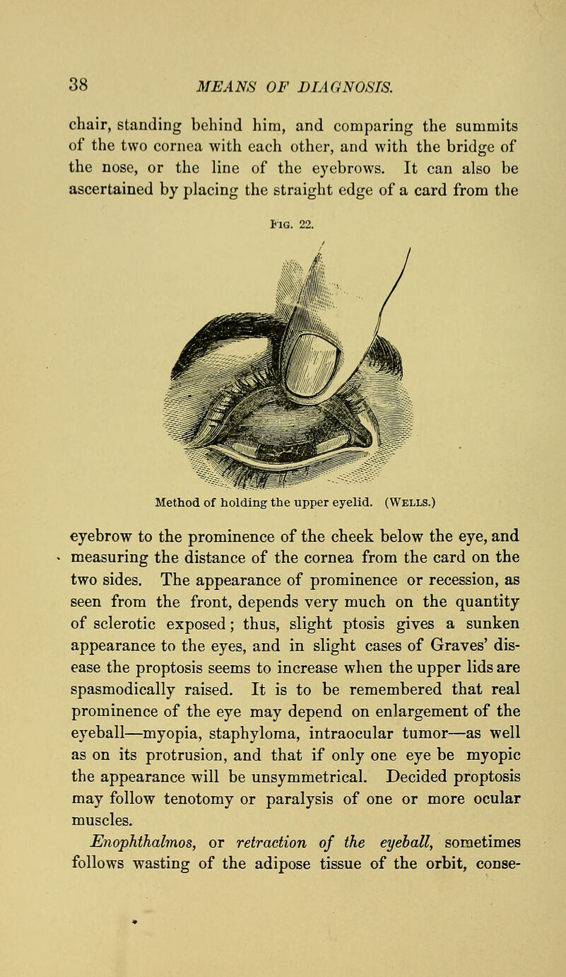 chair, standing behind him, and comparing the summits of the two cornea with each other, and with the bridge of the nose, or the line of the eyebrows. It can also be ascertained by placing the straight edge of a card from the Fig. 22. Method of holding the upper eyelid. (Wells.) eyebrow to the prominence of the cheek below the eye, and measuring the distance of the cornea from the card on the two sides. The appearance of prominence or recession, as seen from the front, depends very much on the quantity of sclerotic exposed; thus, slight ptosis gives a sunken appearance to the eyes, and in slight cases of Graves' dis- ease the proptosis seems to increase when the upper lids are spasmodically raised. It is to be remembered that real prominence of the eye may depend on enlargement of the eyeball—myopia, staphyloma, intraocular tumor—as well as on its protrusion, and that if only one eye be myopic the appearance will be unsymmetrical. Decided proptosis may follow tenotomy or paralysis of one or more ocular muscles. Enophihalmos, or retraction of the eyeball, sometimes follows wasting of the adipose tissue of the orbit, conse-