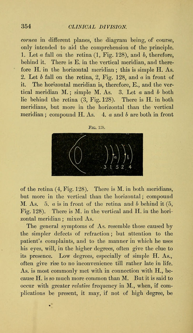 cornea in different planes, the diagram being, of course, only intended to aid the comprehension of the principle. 1. Let a fall on the retina (1, Fig. 128), and b, therefore, behind it. There is E. in the vertical meridian, and there- fore H. in the horizontal meridian; this is simple H. As. 2. Let b fall on the retina, 2, Fig. 128, and a in front of it. The horizontal meridian is, therefore, E., and the ver- tical meridian M.; simple M. As. 3. Let a and b both lie behind the retina (3, Fig. 128). There is H. in both meridians, but more in the horizontal than the vertical meridian ; compound H. As. 4. a and b are both in front Fig. 128. of the retina (4, Fig. 128). There is M. in both meridians, but more in the vertical than the horizontal; compound M. As. 5. a is in front of the retina and b behind it (5, Fig. 128). There is M. in the vertical and H. in the hori- zontal meridian; mixed As. The general symptoms of As. resemble those caused by the simpler defects of refraction; but attention to the patient's complaints, and to the manner in which he uses his eyes, will, in the higher degrees, often give the clue to its presence. Low degrees, especially of simple H. As., often give rise to no inconvenience till rather late in life. As. is most commonly met with in connection with H., be- cause H. is so much more common than M. But it is said to occur with greater relative frequency in M., when, if com- plications be present, it may, if not of high degree, be