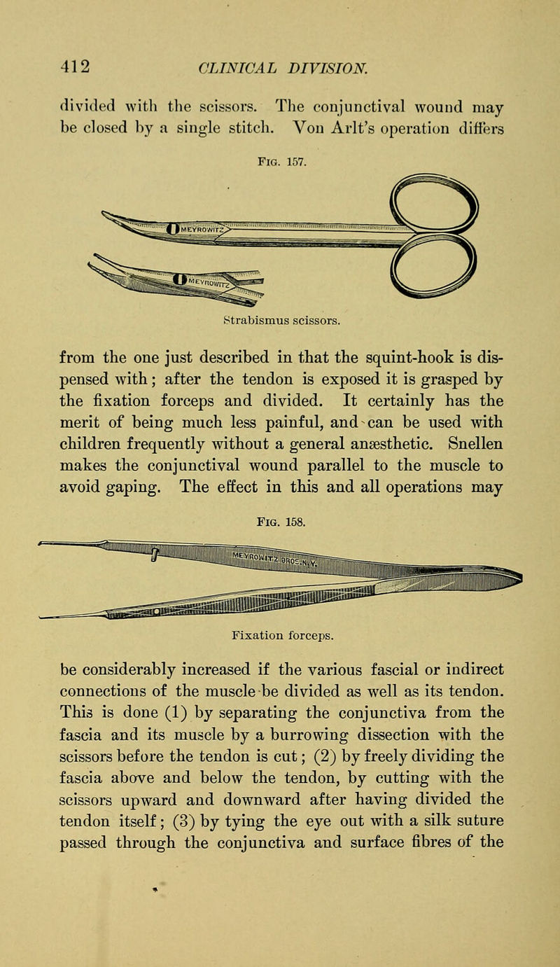 divided with the scissors. The conjunctival wound may be closed by a single stitch. Von Arlt's operation differs Fig. 157. Strabismus scissors. from the one just described in that the squint-hook is dis- pensed with; after the tendon is exposed it is grasped by the fixation forceps and divided. It certainly has the merit of being much less painful, and can be used with children frequently without a general anaesthetic. Snellen makes the conjunctival wound parallel to the muscle to avoid gaping. The effect in this and all operations may Fig. 158. Fixation forceps. be considerably increased if the various fascial or indirect connections of the muscle be divided as well as its tendon. This is done (1) by separating the conjunctiva from the fascia and its muscle by a burrowing dissection with the scissors before the tendon is cut; (2) by freely dividing the fascia above and below the tendon, by cutting with the scissors upward and downward after having divided the tendon itself; (3) by tying the eye out with a silk suture passed through the conjunctiva and surface fibres of the