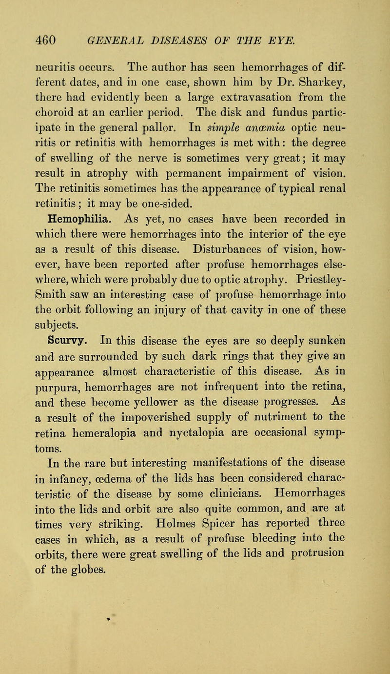 neuritis occurs. The author has seen hemorrhages of dif- ferent dates, and in one case, shown him by Dr. Sharkey, there had evidently been a large extravasation from the choroid at an earlier period. The disk and fundus partic- ipate in the general pallor. In simple anosmia optic neu- ritis or retinitis with hemorrhages is met with: the degree of swelling of the nerve is sometimes very great; it may result in atrophy with permanent impairment of vision. The retinitis sometimes has the appearance of typical renal retinitis; it may be one-sided. Hemophilia. As yet, no cases have been recorded in which there were hemorrhages into the interior of the eye as a result of this disease. Disturbances of vision, how- ever, have been reported after profuse hemorrhages else- where, which were probably due to optic atrophy. Priestley- Smith saw an interesting case of profuse hemorrhage into the orbit following an injury of that cavity in one of these subjects. Scurvy. In this disease the eyes are so deeply sunken and are surrounded by such dark rings that they give an appearance almost characteristic of this disease. As in purpura, hemorrhages are not infrequent into the retina, and these become yellower as the disease progresses. As a result of the impoverished supply of nutriment to the retina hemeralopia and nyctalopia are occasional symp- toms. In the rare but interesting manifestations of the disease in infancy, oedema of the lids has been considered charac- teristic of the disease by some clinicians. Hemorrhages into the lids and orbit are also quite common, and are at times very striking. Holmes Spicer has reported three cases in which, as a result of profuse bleeding into the orbits, there were great swelling of the lids and protrusion of the globes.