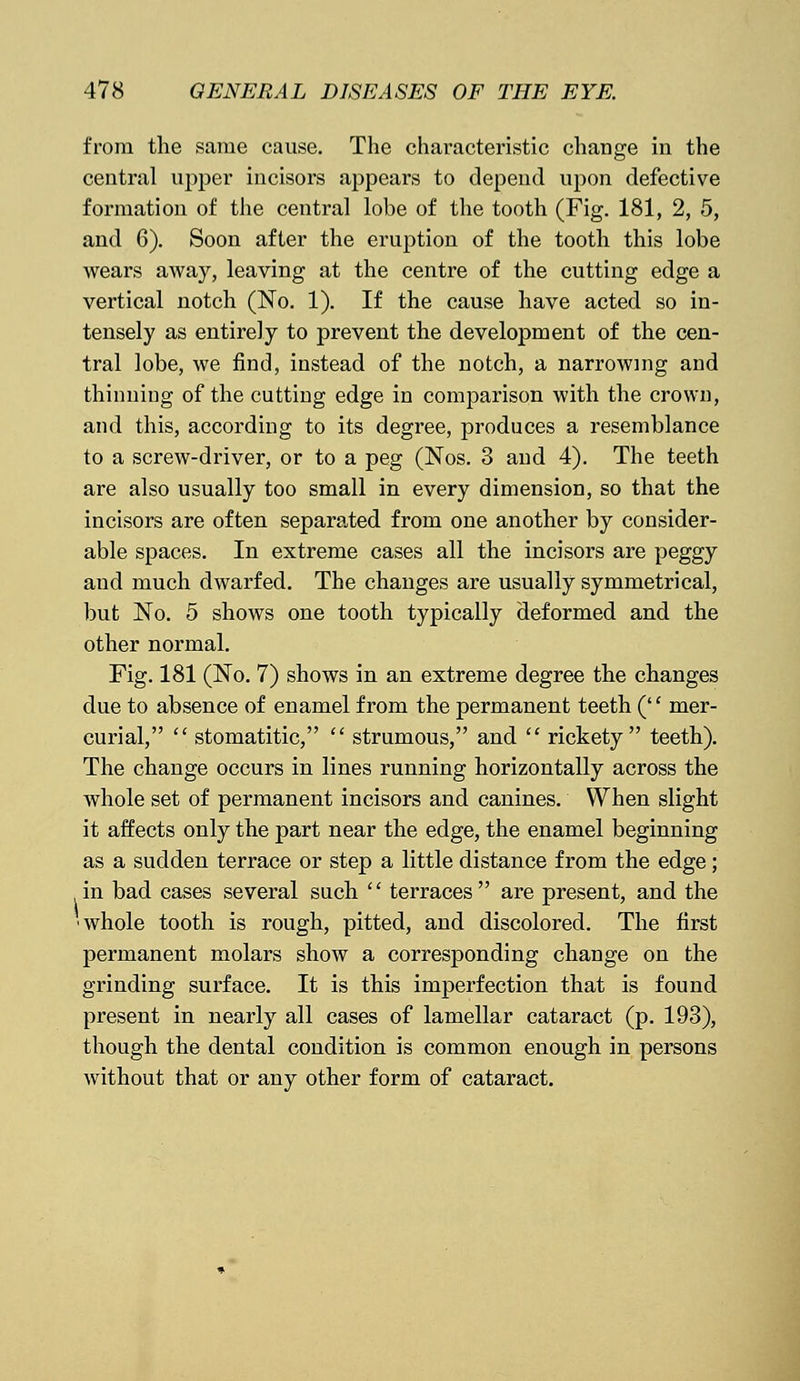 from the same cause. The characteristic change in the central upper incisors appears to depend upon defective formation of the central lobe of the tooth (Fig. 181, 2, 5, and 6). Soon after the eruption of the tooth this lobe wears away, leaving at the centre of the cutting edge a vertical notch (No. 1). If the cause have acted so in- tensely as entirely to prevent the development of the cen- tral lobe, we find, instead of the notch, a narrowing and thinning of the cutting edge in comparison with the crown, and this, according to its degree, produces a resemblance to a screw-driver, or to a peg (Nos. 3 and 4). The teeth are also usually too small in every dimension, so that the incisors are often separated from one another by consider- able spaces. In extreme cases all the incisors are peggy and much dwarfed. The changes are usually symmetrical, but No. 5 shows one tooth typically deformed and the other normal. Fig. 181 (No. 7) shows in an extreme degree the changes due to absence of enamel from the permanent teeth ('' mer- curial,  stomatitic,  strumous, and  rickety teeth). The change occurs in lines running horizontally across the whole set of permanent incisors and canines. When slight it affects only the part near the edge, the enamel beginning as a sudden terrace or step a little distance from the edge; in bad cases several such  terraces are present, and the whole tooth is rough, pitted, and discolored. The first permanent molars show a corresponding change on the grinding surface. It is this imperfection that is found present in nearly all cases of lamellar cataract (p. 193), though the dental condition is common enough in persons without that or any other form of cataract.