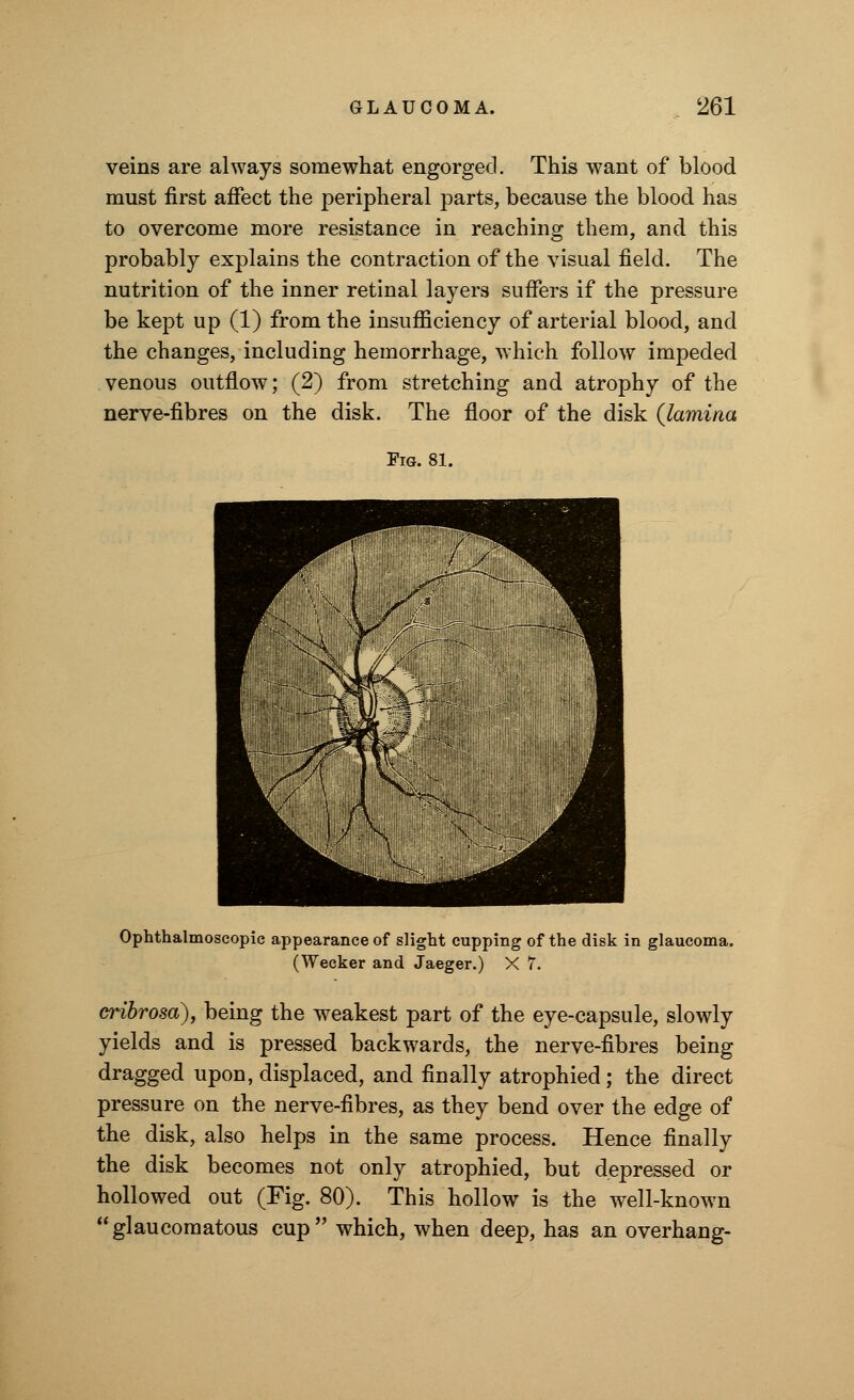 veins are always somewhat engorged. This want of blood must first affect the peripheral parts, because the blood has to overcome more resistance in reaching them, and this probably explains the contraction of the visual field. The nutrition of the inner retinal layers suffers if the pressure be kept up (1) from the insufficiency of arterial blood, and the changes, including hemorrhage, which follow impeded venous outflow; (2) from stretching and atrophy of the nerve-fibres on the disk. The floor of the disk (lamina Fig. 81. Ophthalmoscopic appearance of slight cupping of the disk in glaucoma. (Wecker and Jaeger.) X 7. cribrosa), being the weakest part of the eye-capsule, slowly yields and is pressed backwards, the nerve-fibres being dragged upon, displaced, and finally atrophied; the direct pressure on the nerve-fibres, as they bend over the edge of the disk, also helps in the same process. Hence finally the disk becomes not only atrophied, but depressed or hollowed out (Fig. 80). This hollow is the well-known glaucomatous cup which, when deep, has an overhang-