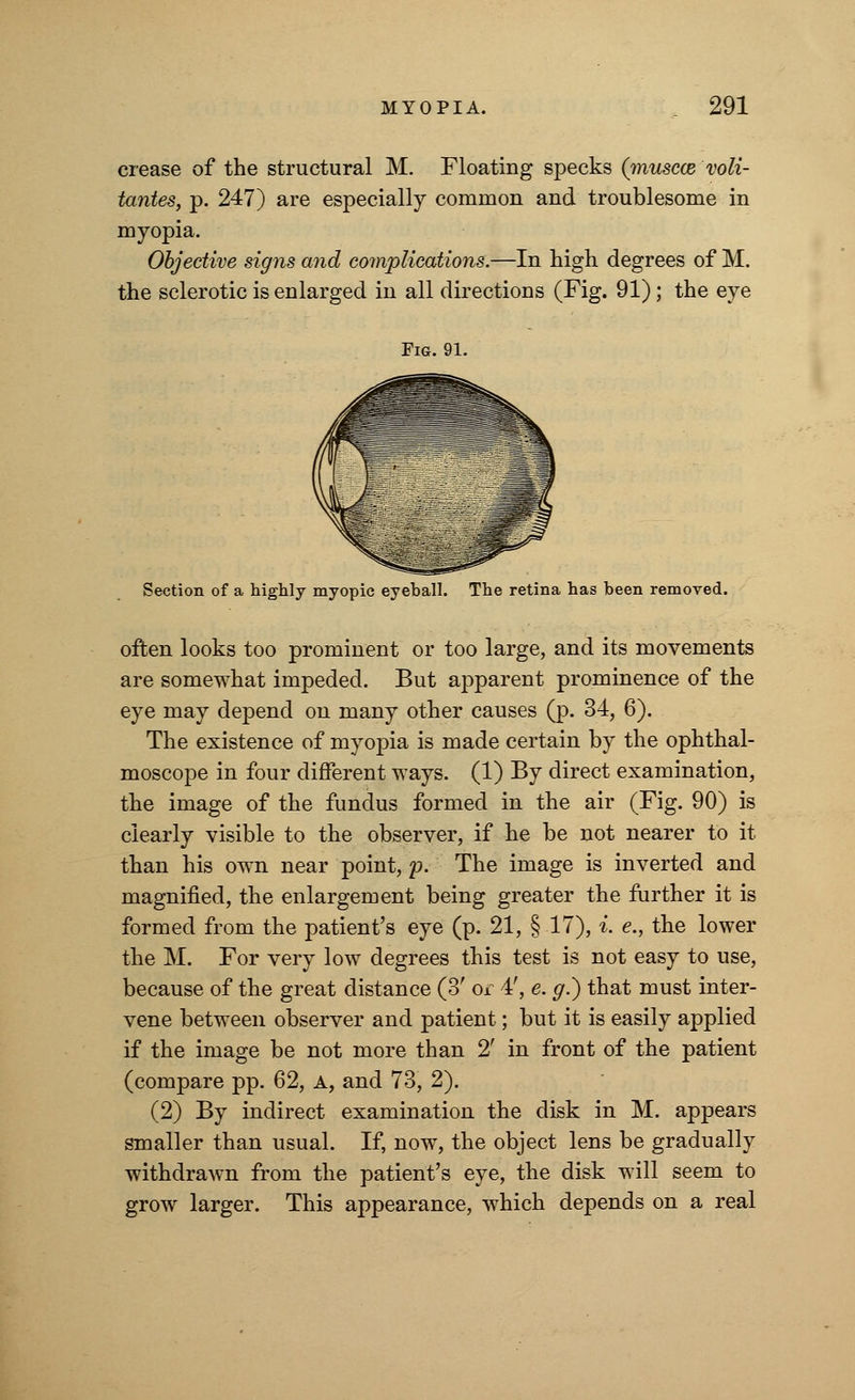 crease of the structural M. Floating specks (muscce voli- tantes, p. 247) are especially common and troublesome in myopia. Objective signs and complications.—In high degrees of M. the sclerotic is enlarged in all directions (Fig. 91) ; the eye Fig. 91. Section of a highly myopic eyeball. The retina has been removed. often looks too prominent or too large, and its movements are somewhat impeded. But apparent prominence of the eye may depend on many other causes (p. 34, 6). The existence of myopia is made certain by the ophthal- moscope in four different ways. (1) By direct examination, the image of the fundus formed in the air (Fig. 90) is clearly visible to the observer, if he be not nearer to it than his own near point, p. The image is inverted and magnified, the enlargement being greater the further it is formed from the patient's eye (p. 21, § 17), i. e., the lower the M. For very low degrees this test is not easy to use, because of the great distance (3' or 4', e. g.) that must inter- vene between observer and patient; but it is easily applied if the image be not more than 2' in front of the patient (compare pp. 62, A, and 73, 2). (2) By indirect examination the disk in M. appears smaller than usual. If, now, the object lens be gradually withdrawn from the patient's eye, the disk will seem to grow larger. This appearance, which depends on a real