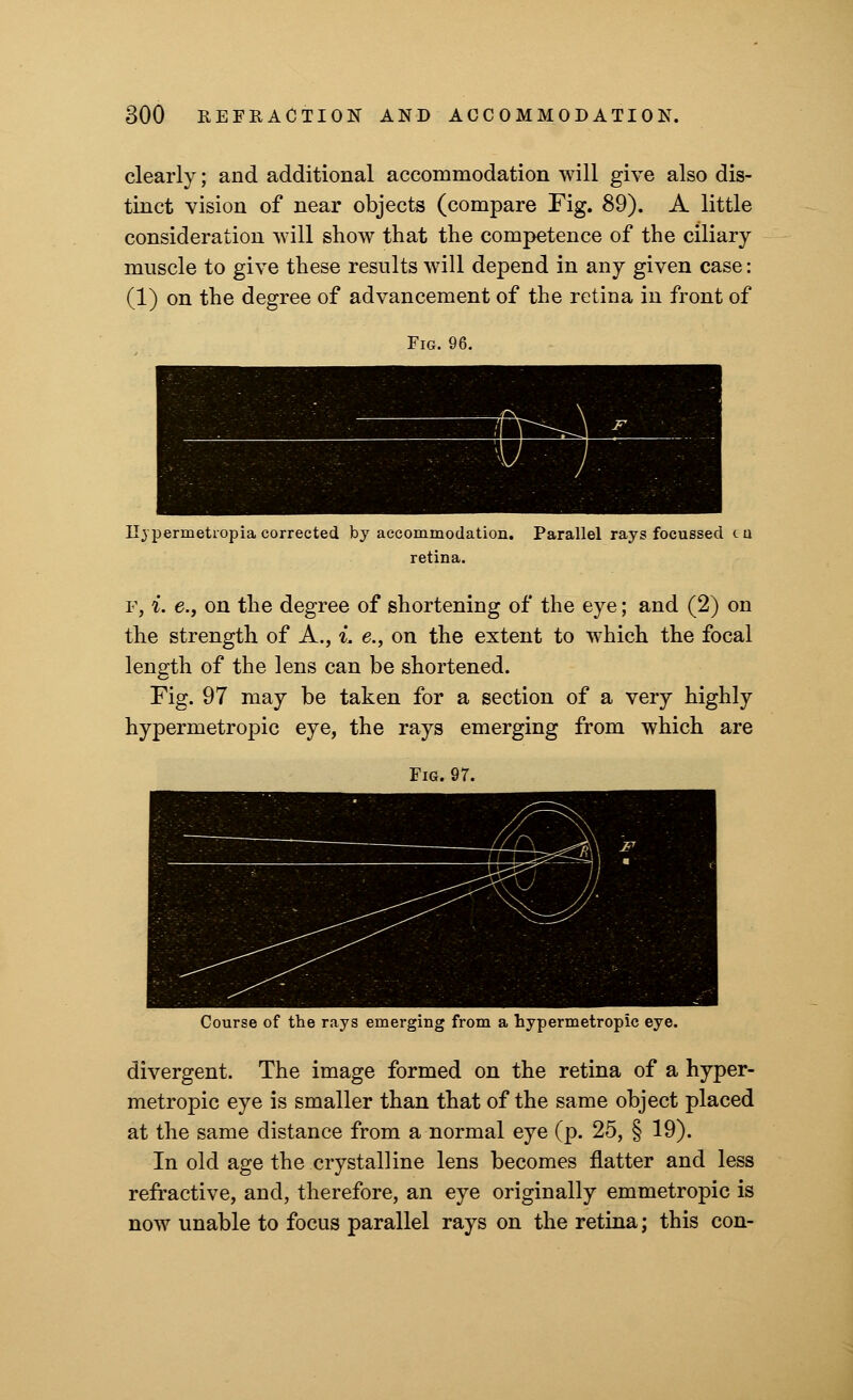 clearly; and additional accommodation will give also dis- tinct vision of near objects (compare Fig. 89). A little consideration will show that the competence of the ciliary muscle to give these results will depend in any given case: (1) on the degree of advancement of the retina in front of 11} permetropia corrected by accommodation. Parallel rays focussed tu retina. f, i. e., on the degree of shortening of the eye; and (2) on the strength of A., i. e., on the extent to which the focal length of the lens can be shortened. Fig. 97 may be taken for a section of a very highly hypermetropic eye, the rays emerging from which are Fig. 97. Course of the rays emerging from a hypermetropic eye. divergent. The image formed on the retina of a hyper- metropic eye is smaller than that of the same object placed at the same distance from a normal eye (p. 25, § 19). In old age the crystalline lens becomes flatter and less refractive, and, therefore, an eye originally emmetropic is now unable to focus parallel rays on the retina; this con-