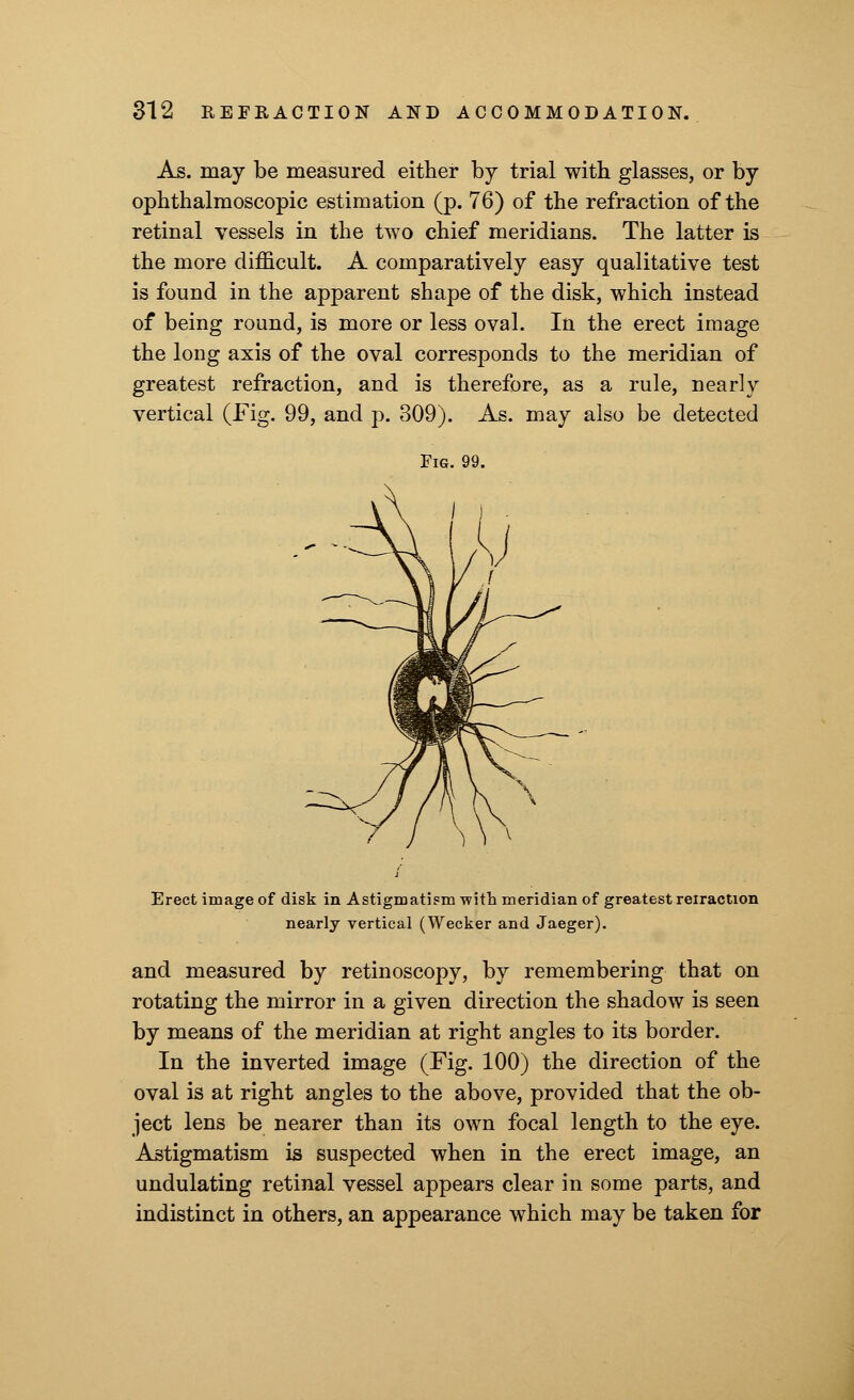 As. may be measured either by trial with glasses, or by ophthalmoscopic estimation (p. 76) of the refraction of the retinal vessels in the two chief meridians. The latter is the more difficult. A comparatively easy qualitative test is found in the apparent shape of the disk, which instead of being round, is more or less oval. In the erect image the long axis of the oval corresponds to the meridian of greatest refraction, and is therefore, as a rule, nearly vertical (Fig. 99, and p. 309). As. may also be detected Fig. 99. Erect image of disk in Astigmatism with meridian of greatest reiraction nearly vertical (Wecker and Jaeger). and measured by retinoscopy, by remembering that on rotating the mirror in a given direction the shadow is seen by means of the meridian at right angles to its border. In the inverted image (Fig. 100) the direction of the oval is at right angles to the above, provided that the ob- ject lens be nearer than its own focal length to the eye. Astigmatism is suspected when in the erect image, an undulating retinal vessel appears clear in some parts, and indistinct in others, an appearance which may be taken for