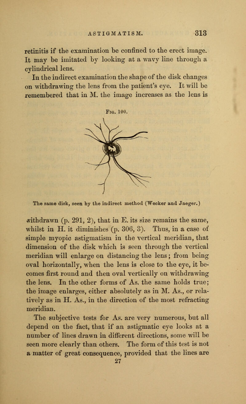 retinitis if the examination be confined to the erect image. It may be imitated by looking at a wavy line through a cylindrical lens. In the indirect examination the shape of the disk changes on withdrawing the lens from the patient's eye. It will be remembered that in M. the image increases as the lens is Fig. 100. The same disk, seen by the indirect method (Wecker and Jaeger.) withdrawn (p. 291, 2), that in E. its size remains the same, whilst in H. it diminishes (p. 306, 3). Thus, in a case of simple myopic astigmatism in the vertical meridian, that dimension of the disk which is seen through the vertical meridian will enlarge on distancing the lens; from being oval horizontally, when the lens is close to the eye, it be- comes first round and then oval vertically on withdrawing the lens. In the other forms of As. the same holds true; the image enlarges, either absolutely as in M. As., or rela- tively as in H. As., in the direction of the most refracting meridian. The subjective tests for As. are very numerous, but all depend on the fact, that if an astigmatic eye looks at a number of lines drawn in different directions, some will be seen more clearly than others. The form of this test is not a matter of great consequence, provided that the lines are 27