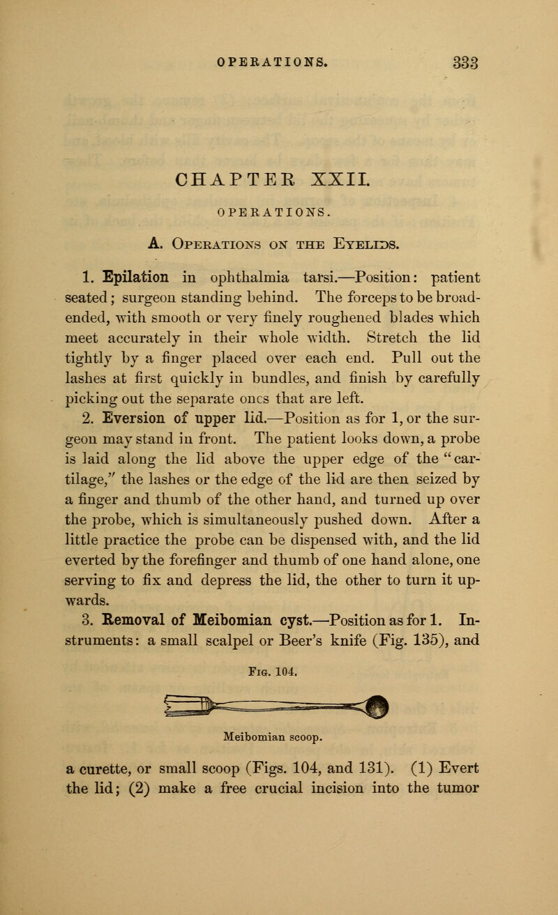 CHAPTER XXII. OPERATIONS. A. Operations on the Eyelids. 1. Epilation in ophthalmia tarsi.—Position: patient seated; surgeon standing behind. The forceps to be broad- ended, with smooth or very finely roughened blades which meet accurately in their whole width. Stretch the lid tightly by a finger placed over each end. Pull out the lashes at first quickly in bundles, and finish by carefully picking out the separate ones that are left. 2. Eversion of upper lid.—Position as for 1, or the sur- geon may stand in front. The patient looks down, a probe is laid along the lid above the upper edge of the car- tilage, the lashes or the edge of the lid are then seized by a finger and thumb of the other hand, and turned up over the probe, which is simultaneously pushed down. After a little practice the probe can be dispensed with, and the lid everted by the forefinger and thumb of one hand alone, one serving to fix and depress the lid, the other to turn it up- wards. 3. Removal of Meibomian cyst.—Position as fori. In- struments : a small scalpel or Beer's knife (Fig. 135), and Fig. 104. Meibomian scoop. a curette, or small scoop (Figs. 104, and 131). (1) Evert the lid; (2) make a free crucial incision into the tumor