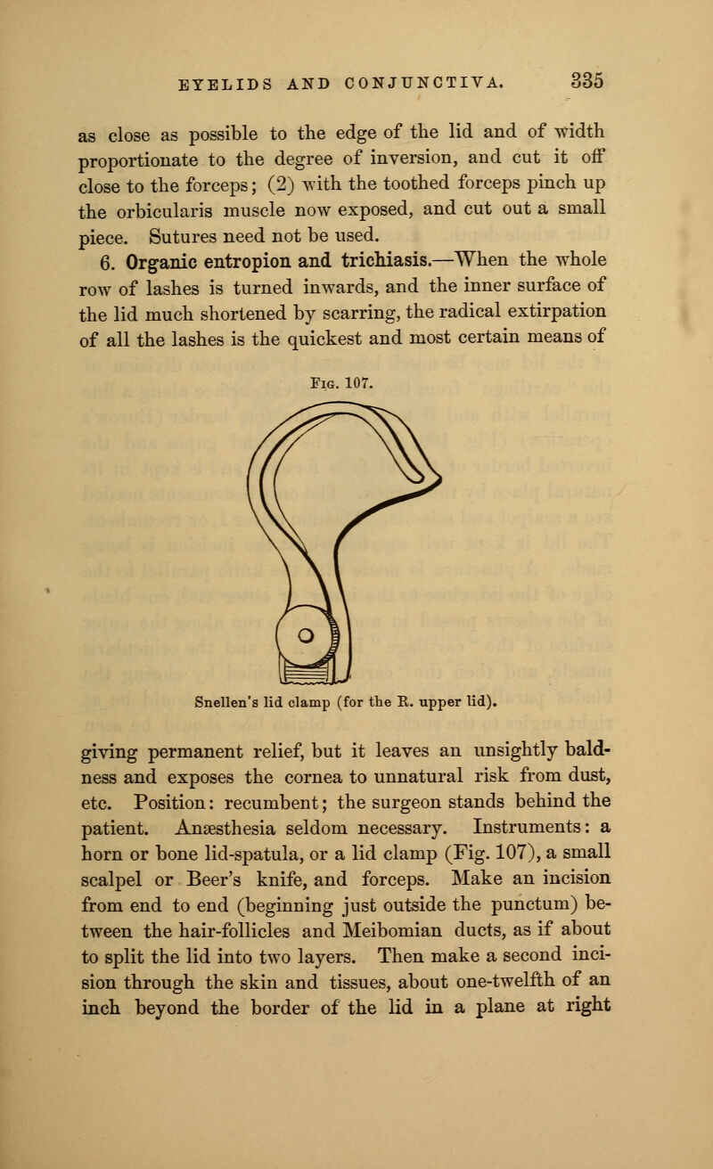 as close as possible to the edge of the lid and of width proportionate to the degree of inversion, and cut it off close to the forceps; (2) with the toothed forceps pinch up the orbicularis muscle now exposed, and cut out a small piece. Sutures need not be used. 6. Organic entropion and trichiasis.—When the whole row of lashes is turned inwards, and the inner surface of the lid much shortened by scarring, the radical extirpation of all the lashes is the quickest and most certain means of Eig. 107. Snellen's lid clamp (for the R. upper lid) giving permanent relief, but it leaves an unsightly bald- ness and exposes the cornea to unnatural risk from dust, etc. Position: recumbent; the surgeon stands behind the patient. Anaesthesia seldom necessary. Instruments: a horn or bone lid-spatula, or a lid clamp (Fig. 107), a small scalpel or Beer's knife, and forceps. Make an incision from end to end (beginning just outside the punctum) be- tween the hair-follicles and Meibomian ducts, as if about to split the lid into two layers. Then make a second inci- sion through the skin and tissues, about one-twelfth of an inch beyond the border of the lid in a plane at right