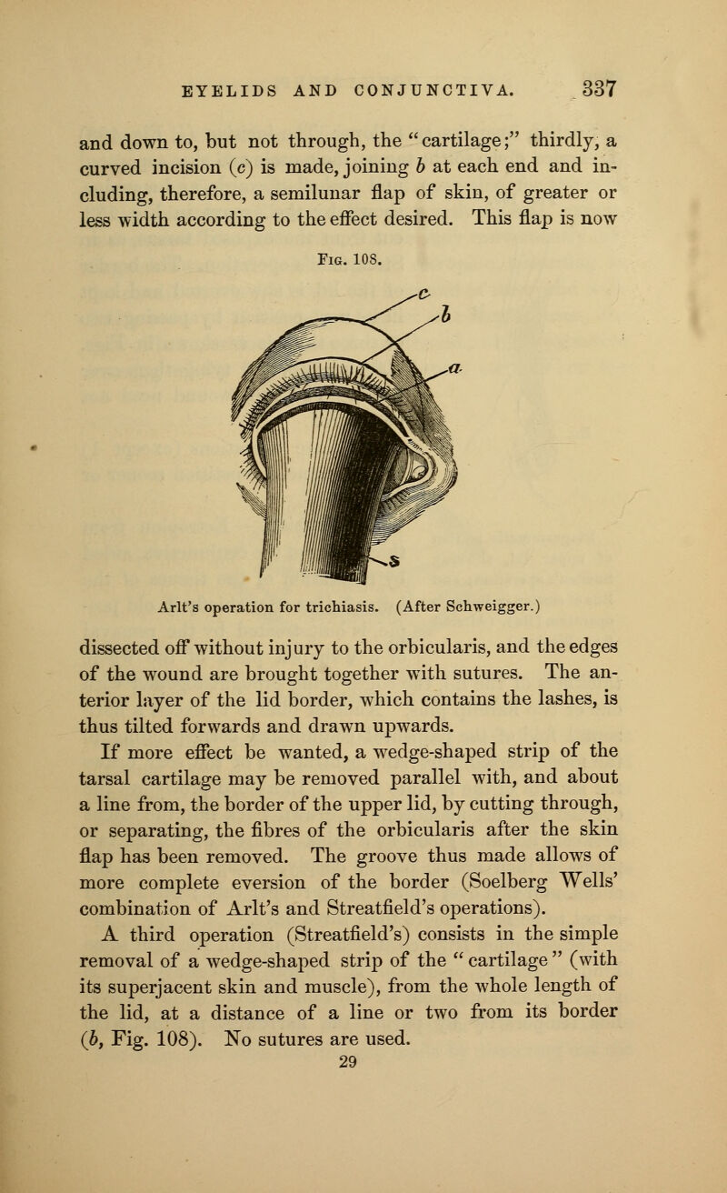 and down to, but not through, the cartilage; thirdly, a curved incision (c) is made, joining b at each end and in- cluding, therefore, a semilunar flap of skin, of greater or less width according to the effect desired. This flap is now Fig. 10S. Arlt's operation for trichiasis. (After Schweigger.) dissected off without injury to the orbicularis, and the edges of the wound are brought together with sutures. The an- terior layer of the lid border, which contains the lashes, is thus tilted forwards and drawn upwards. If more effect be wanted, a wedge-shaped strip of the tarsal cartilage may be removed parallel with, and about a line from, the border of the upper lid, by cutting through, or separating, the fibres of the orbicularis after the skin flap has been removed. The groove thus made allows of more complete eversion of the border (Soelberg Wells' combination of Arlt's and Streatfield's operations). A third operation (Streatfield's) consists in the simple removal of a wedge-shaped strip of the  cartilage  (with its superjacent skin and muscle), from the whole length of the lid, at a distance of a line or two from its border (b, Fig. 108). No sutures are used. 29