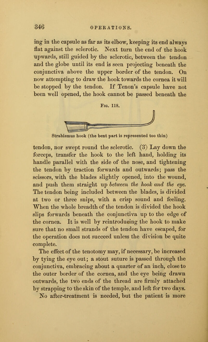 ing in the capsule as far as its elbow, keeping its end always flat against the sclerotic. Next turn the end of the hook upwards, still guided by the sclerotic, between the tendon and the globe until its end is seen projecting beneath the conjunctiva above the upper border of the tendon. On now attempting to draw the hook towards the cornea it will be stopped by the tendon. If Tenon's capsule have not been well opened, the hook cannot be passed beneath the Fig. 118. Strabismus hook (the bent part is represented too thin) tendon, nor swept round the sclerotic. (3) Lay down the forceps, transfer the hook to the left hand, holding its handle parallel with the side of the nose, and tightening the tendon by traction forwards and outwards; pass the scissors, with the blades slightly opened, into the wound, and push them straight up between the hook and the eye. The tendon being included between the blades, is divided at two or three snips, with a crisp sound and feeling. When the whole breadth of the tendon is divided the hook slips forwards beneath the conjunctiva up to the edge of the cornea. It is well by reintroducing the hook to make sure that no small strands of the tendon have escaped, for the operation does not succeed unless the division be quite complete. The effect of the tenotomy may, if necessary, be increased by tying the eye out; a stout suture is passed through the conjunctiva, embracing about a quarter of an inch, close to the outer border of the cornea, and the eye being drawn outwards, the two ends of the thread are firmly attached by strapping to the skin of the temple, and left for two days. No after-treatment is needed, but the patient is more