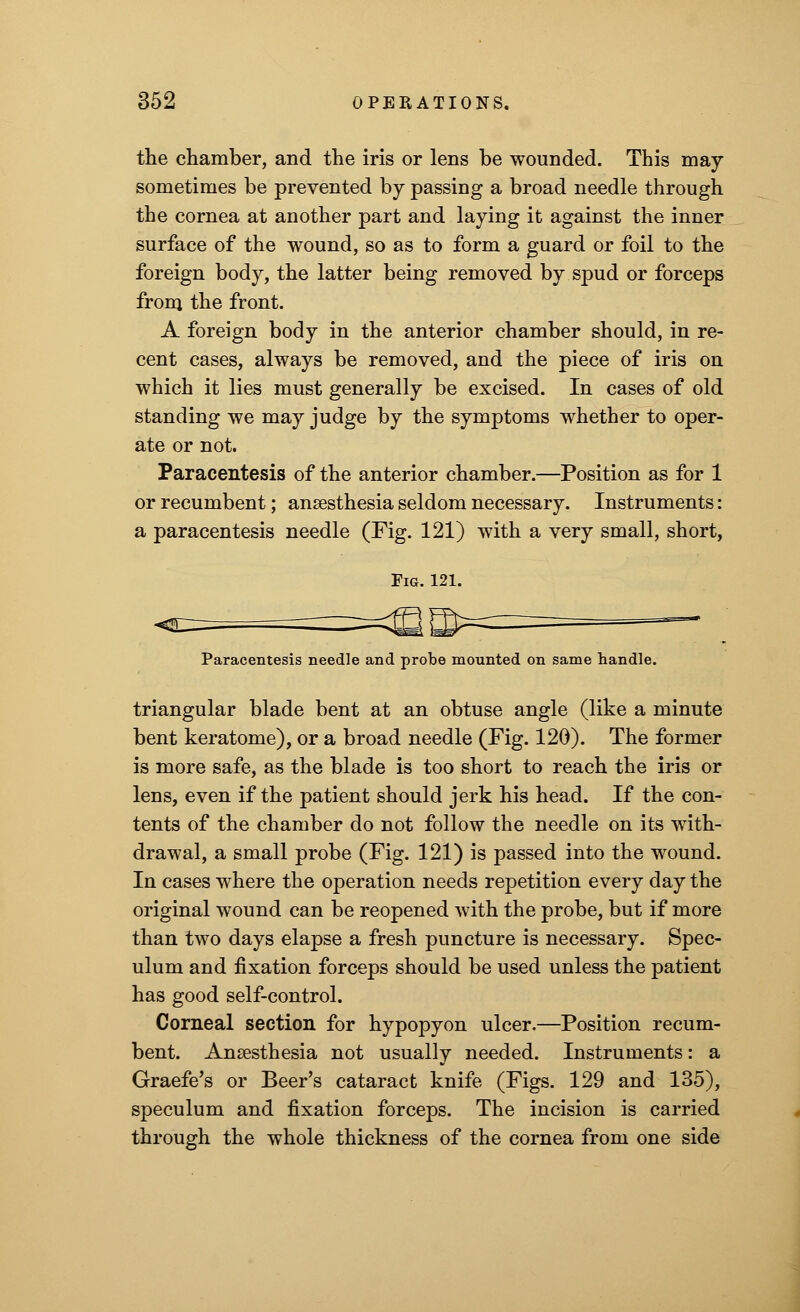 the chamber, and the iris or lens be wounded. This may sometimes be prevented by passing a broad needle through the cornea at another part and laying it against the inner surface of the wound, so as to form a guard or foil to the foreign body, the latter being removed by spud or forceps from the front. A foreign body in the anterior chamber should, in re- cent cases, always be removed, and the piece of iris on which it lies must generally be excised. In cases of old standing we may judge by the symptoms whether to oper- ate or not. Paracentesis of the anterior chamber.—Position as for 1 or recumbent; anaesthesia seldom necessary. Instruments: a paracentesis needle (Fig. 121) with a very small, short, Paracentesis needle and probe mounted on same handle. triangular blade bent at an obtuse angle (like a minute bent keratome), or a broad needle (Fig. 120). The former is more safe, as the blade is too short to reach the iris or lens, even if the patient should jerk his head. If the con- tents of the chamber do not follow the needle on its with- drawal, a small probe (Fig. 121) is passed into the wound. In cases where the operation needs repetition every day the original wound can be reopened with the probe, but if more than two days elapse a fresh puncture is necessary. Spec- ulum and fixation forceps should be used unless the patient has good self-control. Corneal section for hypopyon ulcer.—Position recum- bent. Anaesthesia not usually needed. Instruments: a Graefe's or Beer's cataract knife (Figs. 129 and 135), speculum and fixation forceps. The incision is carried through the whole thickness of the cornea from one side