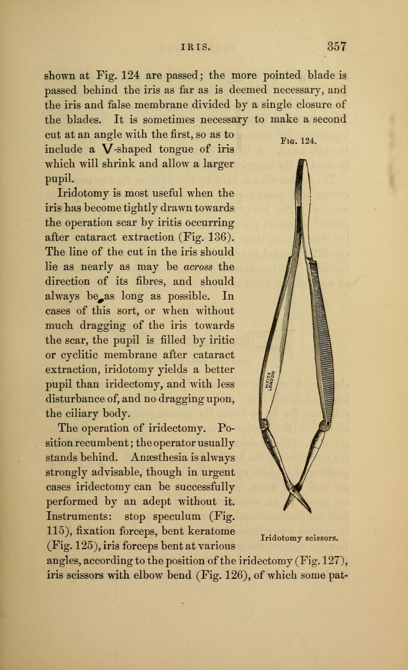 Fig. 124. shown at Fig. 124 are passed; the more pointed blade is passed behind the iris as far as is deemed necessary, and the iris and false membrane divided by a single closure of the blades. It is sometimes necessary to make a second cut at an angle with the first, so as to include a V-shaped tongue of iris which will shrink and allow a larger pupil. Iridotomy is most useful when the iris has become tightly drawn towards the operation scar by iritis occurring after cataract extraction (Fig. 136). The line of the cut in the iris should lie as nearly as may be across the direction of its fibres, and should always be^as long as possible. In cases of this sort, or when without much dragging of the iris towards the scar, the pupil is filled by iritic or cyclitic membrane after cataract extraction, iridotomy yields a better pupil than iridectomy, and with less disturbance of, and no dragging upon, the ciliary body. The operation of iridectomy. Po- sition recumbent; the operator usually stands behind. Anaesthesia is always strongly advisable, though in urgent cases iridectomy can be successfully performed by an adept without it. Instruments: stop speculum (Fig. 115), fixation forceps, beut keratome (Fig. 125), iris forceps bent at various angles, according to the position of the iridectomy (Fig. 127), iris scissors with elbow bend (Fig. 126), of which some pat- Iridotomy scissors.