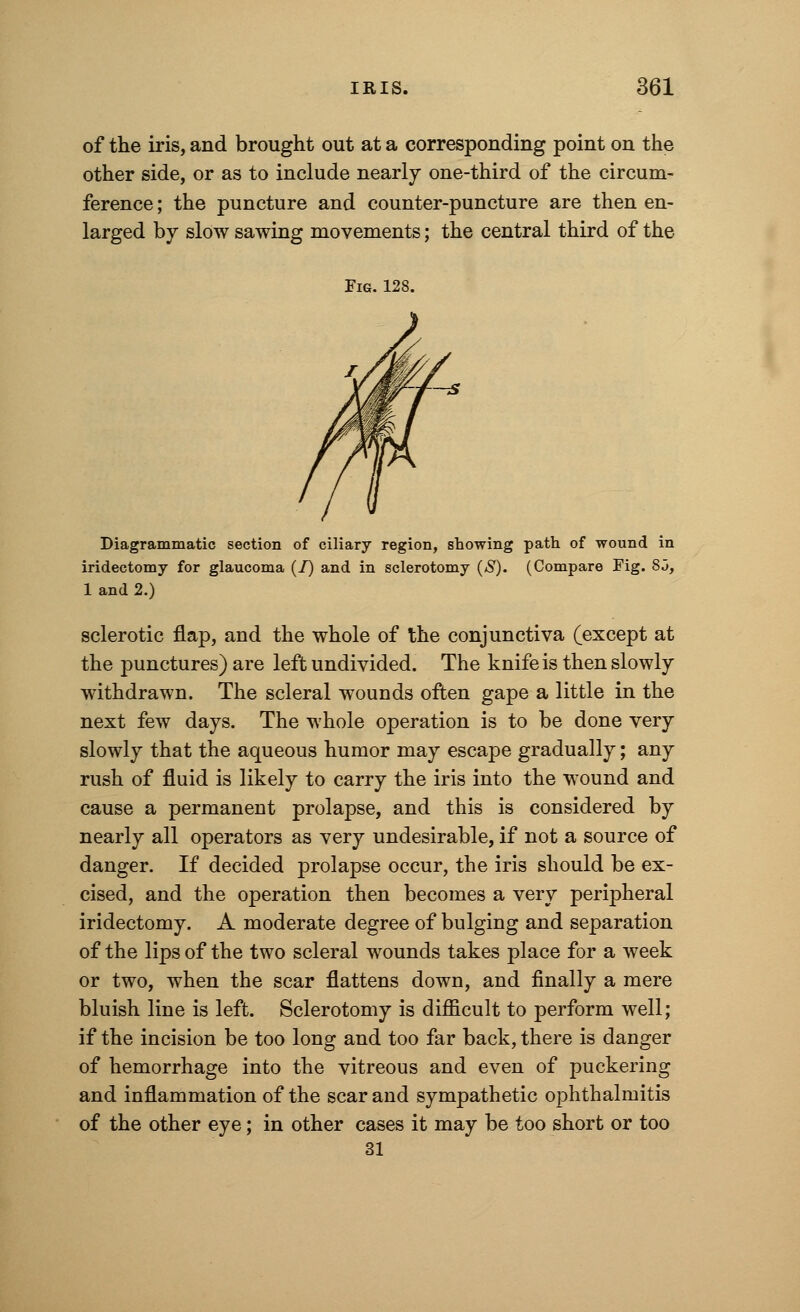 of the iris, and brought out at a corresponding point on the other side, or as to include nearly one-third of the circum- ference ; the puncture and counter-puncture are then en- larged by slow sawing movements; the central third of the Fig. 128. Diagrammatic section of ciliary region, showing path of wound in iridectomy for glaucoma (I) and in sclerotomy (S). (Compare Fig. S3, 1 and 2.) sclerotic flap, and the whole of the conjunctiva (except at the punctures) are left undivided. The knife is then slowly withdrawn. The scleral wounds often gape a little in the next few days. The whole operation is to be done very slowly that the aqueous humor may escape gradually; any rush of fluid is likely to carry the iris into the wound and cause a permanent prolapse, and this is considered by nearly all operators as very undesirable, if not a source of danger. If decided prolapse occur, the iris should be ex- cised, and the operation then becomes a very peripheral iridectomy. A moderate degree of bulging and separation of the lips of the two scleral wounds takes place for a week or two, when the scar flattens down, and finally a mere bluish line is left. Sclerotomy is difficult to perform well; if the incision be too long and too far back, there is danger of hemorrhage into the vitreous and even of puckering and inflammation of the scar and sympathetic ophthalmitis of the other eye; in other cases it may be too short or too 31