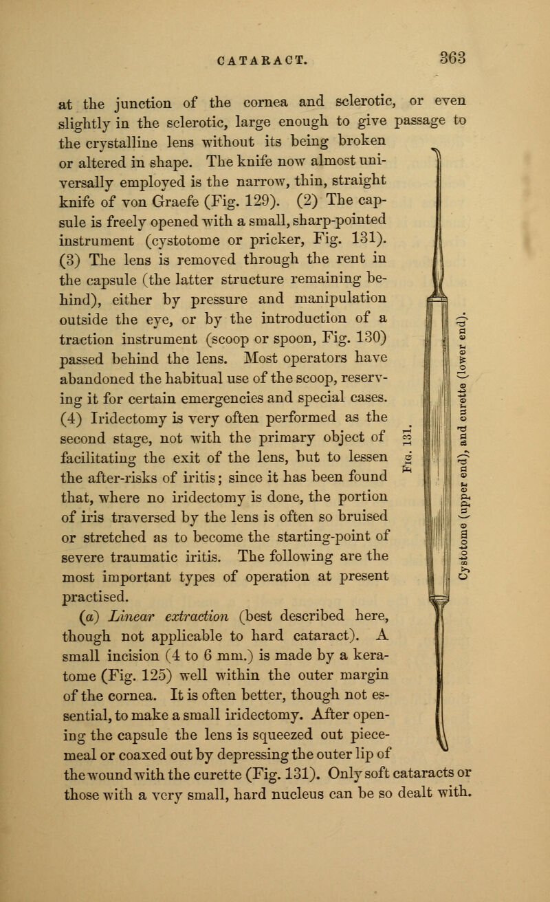 at the junction of the cornea and sclerotic, or even slightly in the sclerotic, large enough to give passage to the crystalline lens without its being broken or altered in shape. The knife now almost uni- versally employed is the narrow, thin, straight knife of von Graefe (Fig. 129). (2) The cap- sule is freely opened with a small, sharp-pointed instrument (cystotome or pricker, Fig. 131). (3) The lens is removed through the rent in the capsule (the latter structure remaining be- hind), either by pressure and manipulation outside the eye, or by the introduction of a traction instrument (scoop or spoon, Fig. 130) passed behind the lens. Most operators have abandoned the habitual use of the scoop, reserv- ing it for certain emergencies and special cases. (4) Iridectomy is very often performed as the second stage, not with the primary object of g j || g facilitating the exit of the lens, but to lessen g the after-risks of iritis; since it has been found that, where no iridectomy is done, the portion of iris traversed by the lens is often so bruised or stretched as to become the starting-point of severe traumatic iritis. The following are the | j most important types of operation at present practised. (a) Linear extraction (best described here, though not applicable to hard cataract). A small incision (4 to 6 mm.) is made by a kera- tome (Fig. 125) well within the outer margin of the cornea. It is often better, though not es- sential, to make a small iridectomy. After open- ing the capsule the lens is squeezed out piece- meal or coaxed out by depressing the outer lip of the wound with the curette (Fig. 131). Only soft cataracts or those with a very small, hard nucleus can be so dealt with.