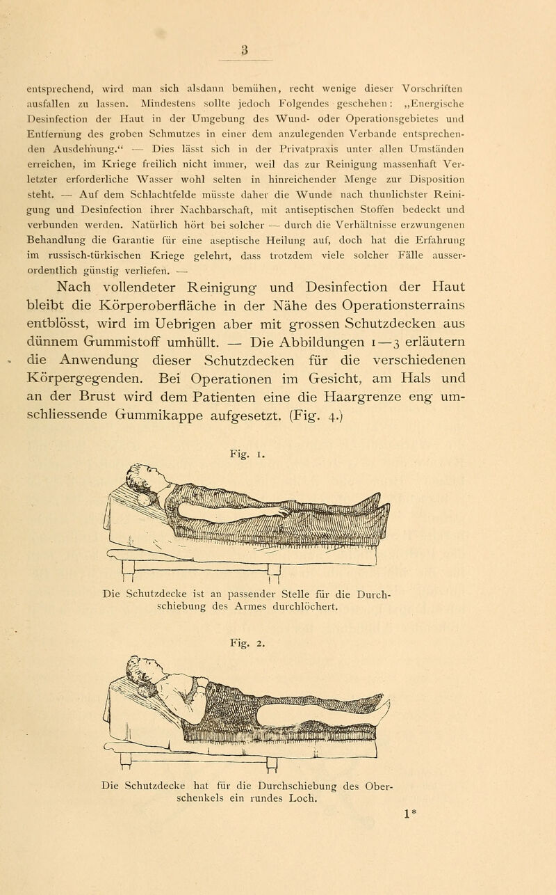 entsprechend, wird man sich alsdann bemühen, recht wenige dieser Vorschriften ausfallen zu lassen. Mindestens sollte jedoch Folgendes geschehen: „Energische Desinfection der Haut in der Umgebung des Wund- oder Operationsgebietes und Entfernung des groben Schmutzes in einer dem anzulegenden Verbände entsprechen- den Ausdehnung. — Dies lässt sich in der Privatpraxis unter allen Umständen erreichen, im Kriege freilich nicht immer, weil das zur Reinigung massenhaft Ver- letzter erforderliche Wasser wohl selten in hinreichender Menge zur Disposition steht. — Auf dem Schlachtfelde müsste daher die Wunde nach thunlichster Reini- gung und Desinfection ihrer Nachbarschaft, mit antiseptischen Stoffen bedeckt und verbunden werden. Natürlich hört bei solcher — durch die Verhältnisse erzwungenen Behandlung die Garantie für eine aseptische Heilung auf, doch hat die Erfahrung im russisch-türkischen Kriege gelehrt, dass trotzdem viele solcher Fälle ausser- ordentlich günstig verliefen. — Nach vollendeter Reinigung und Desinfection der Haut bleibt die Körperoberfläche in der Nähe des Operationsterrains entblösst, wird im Uebrigen aber mit grossen Schutzdecken aus dünnem Gummistoff umhüllt. — Die Abbildungen i—3 erläutern die Anwendung dieser Schutzdecken für die verschiedenen Körpergegenden. Bei Operationen im Gesicht, am Hals und an der Brust wird dem Patienten eine die Haargrenze eng um- schliessende Gummikappe aufgesetzt. (Fig. 4.) Fig. I. Die Schutzdecke ist an passender Stelle für die Durch- schiebung des Armes durchlöchert. Fig. 2. Die Schutzdecke hat für die Durchschiebung des Ober- schenkels ein rundes Loch.