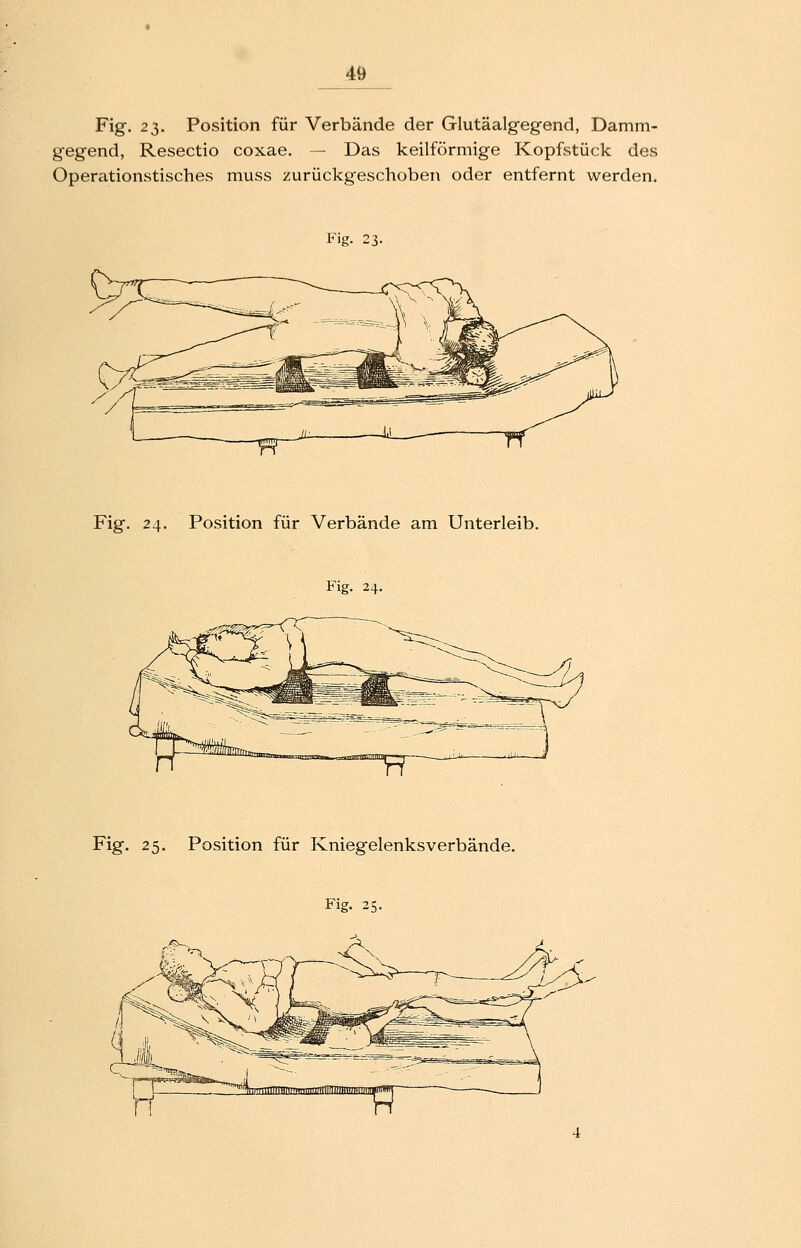 Fig. 23. Position für Verbände der Glutäalgegend, Damm- gegend, Resectio coxae. — Das keilförmige Kopfstück des Operationstisches muss zurückgeschoben oder entfernt werden. Fig. 23. —pnTT Fig. 24. Position für Verbände am Unterleib. Fig. 24. Fig. 25. Position für Kniegelenksverbände. Fig- 25.