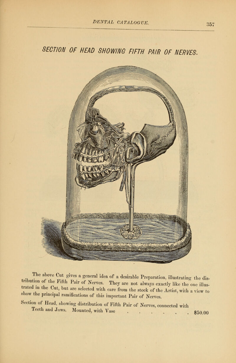 357 SECTION OF HEAD SHOWING FIFTH PAIR OF NERVES. The above Cut gives a general idea of a desirable Preparation, illustrating the dis- nbution of the Fifth Pair of Nerves. They are not always exactly like the one illus- trated in the Cut, but are selected with care from the stock of the Artist, with a view tc show the principal ramifications of this important Pair of Nerves. Section of Head, showing distribution of Fifth Pair of Nerves, connected with Teeth and Jaws. Mounted, with Vase $50 00