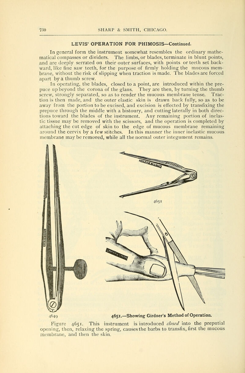 LEVIS' OPERATION FOR PHIMOSIS—Continued. In general form the instrument somewhat resembles the ordinary mathe- matical compasses or dividers. The limbs, or blades, terminate in blunt points, and are deeply serrated on their outer surfaces, with points or teeth set back- ward, like fine saw teeth, for the purpose of firmly holding the mucous mem- brane, without the risk of slipping when traction is made. The blades are forced apart by a thumb screw. In operating, the blades, closed to a point, are introduced within the pre- puce up beyond the corona of the glans. They are then, by turning the thumb screw, strongly separated, so as to render the mucous membrane tense. Trac- tion is then made, and the outer elastic skin is drawn back fully, so as to be away from the portion to be excised, and excision is effected by transfixing the prepuce through the middle with a bistoury, and cutting laterally in both direc- tions toward the blades of the instrument. Any remaining portion of inelas- tic tissue may be removed with the scissors, and the operation is completed by attaching the cut edge of skin to the edge of mucous membrane remaining around the cervix by a few stitches. In this manner the inner inelastic mucous membrane may be removed, while all the normal outer integument remains. 4651 4649 4651.—Showing Girdner's Method of Operation. Figure 4651. This instrument is introduced dosed into the preputial opening, then, relaxing the spring, causes the barbs to transfix, first the mucous membrane, and then the skin.