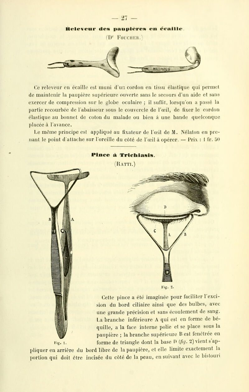 zi (I)' l'oi (;iii;ii. rmsia (!c roluvoiir ou écaille est imiiii d'ii:; cordon en lissu clusliqiic (jiii [jcimkîI de niiiiiitciiir la paupière supérieure ouverte sans le secours d'un aide et sans exercer de compression sur le globe oculaire ; il suffit, lorsqu'on a passé lu partie recourbée de l'abaisselir sous le couvercle de l'œil, de fixer le cordon élastique au bonnet de coton du malade ou biciii à une bande (jnclconque placée à l'avance. Le même principe esl appliqué au fixateur de l'oîil de M. Nélaton en pie- nant le point d attache sur l'oreille du côté de l'œil à opérer. — Prix : I Ir. tio Pince à Tricliiasiis. (IIatti.) Cette pince a été imaginée pour faciliter l'exci- sion du bord ciliaire ainsi que des bulbes, avec une grande précision et sans écoulement de sang. La branche inférieure A qui esl en forme de bé- quille, a la face interne polie et se place sous la paupière ; la branche supérieure B est fenêtrée en forme de triangle dont la base H {fig. 2) vient s'ap- pliquer en arrière du bord libre de la paupière, et elle limite exactement la portion qui doit être incisée du côté de la peau, en suivant avec le bistouri