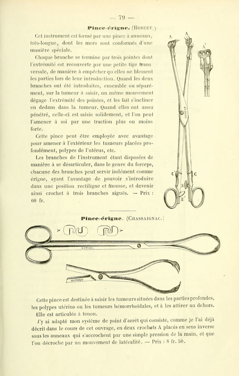 7!) — ■■lnr4'-4-ri«;ii<'. (ll(ii'.i;iiT_' i'.c.l iiisIriuncMl csl runnô par imc, [ùwva'. à atiiKiaiix, Irrs-lniij^iii', dont les mors soiil conf()rni(''s d'iiiK! maiiirrc s|i(''(ial(\. (lliaqur hraiiclio so lorininc. [lar trois poinlcs dotil l'cNlri'inih' (>st rccoiivni'lc, pai' une pclilc lif^c Iraus M'i'salo, (le. maiiirrc à cmpt^rliiM'(|iiCllcs iir, IjIcsscuI les parlii's lors de leur iniroducliou. (Jm'-i'i' ^^^ deux hrauciies ont été iulrodiiilcs, enscmblo ou scpar^- inonl, sur la luiiieur à saisir, un niOrnc! mouveinent. dégaf^e l'extrémité des pointes, et les fait s'incliner en dedans dans la tumeur. Quand elles ont assez pénétré, celle-ci est saisie solidement, et l'on peut l'amener t\ soi par une traction plus ou moins Ibrtc. Cette pince peut être employée avec avantage pour amener à l'extérieur les tumeurs placées pro- fondément, polypes de l'utérus, etc. Les branches de l'instrument étant disposées de manière à se désarticuler, dans le genre du forceps, chacune des branches peut servir isolément comme érigne, ayant l'avantage de pouvoir s'introduire dans une position rectiligne et fnoussc, et devenir ainsi crochet à trois branches aiguës. — Prix : 60 fr. Pînce-érigne. (ChassaiCtNac.) Cette pince est destinée à saisir les tumeurs situées dans les parties profondes, les polypes utérins ou les tumeurs hémorrhoïdales, et à. les attirer au dehors. Elle est articulée à tenon. J'y ai adapté mon système de point d'arrêt qui consiste, comme je l'ai déjà décrit dans le cours de cet ouvrage, en deux crochets A placés en sens inverse sous les anneaux qui s'accrochent par une simple pression de la main, et que l'on décroche par un mouvement de latéralité. — Prix : S fr. oO.