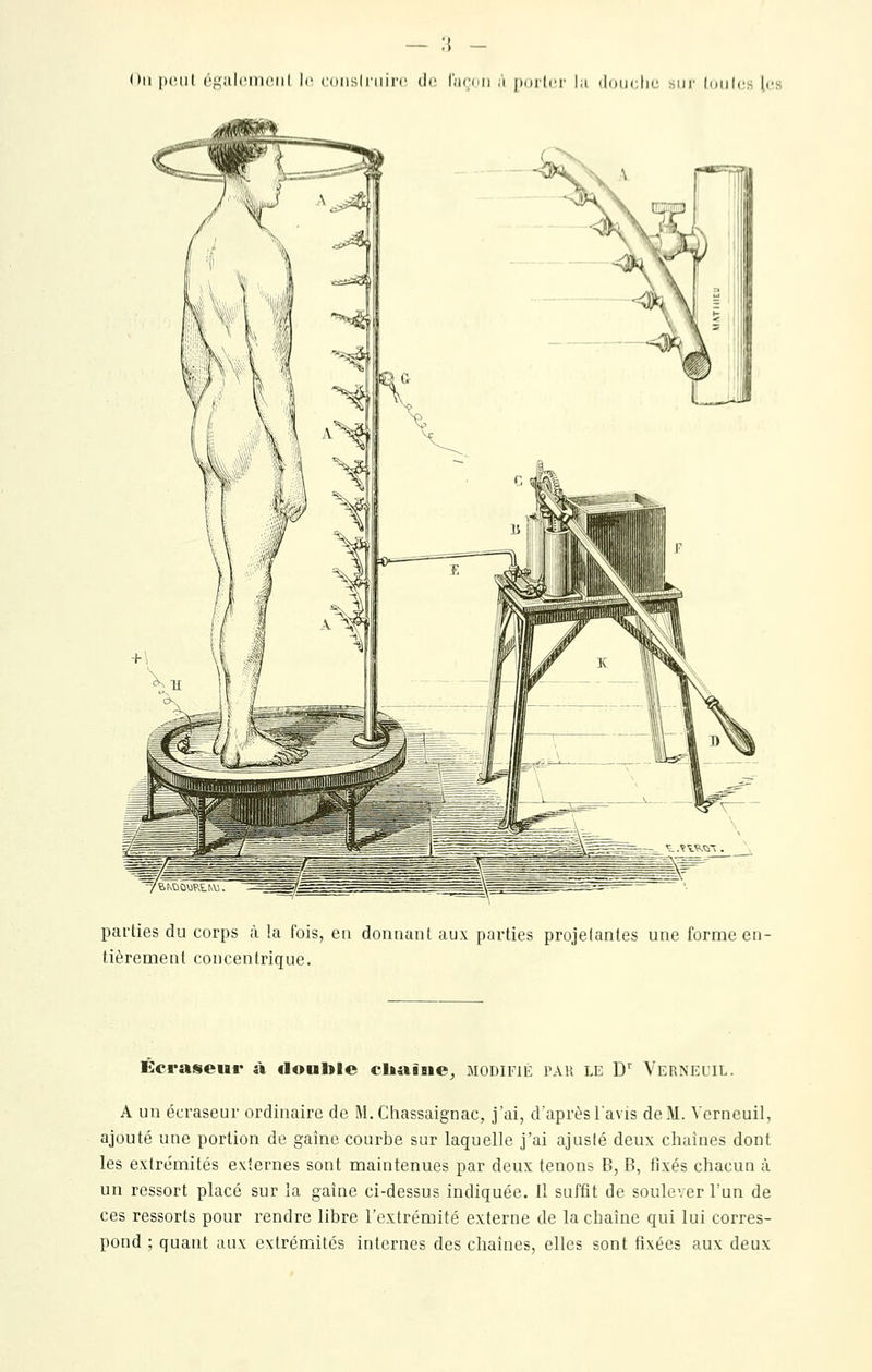 On |)('iil {■f^alcmciil le ((nislniirr de Cicdii ,'i poilci' |;i (Idiiclu; sur loiihis les parties du corps à la fois, eu donnant aux parties projetantes une forme en- tièrement concentrique. Écraseur à double cltaiaie^ modifié par le D'' Vernelil. A un écraseur ordinaire de M.Chassaignac, j'ai, d'après l'avis deM. Verneuil, ajouté une portion de gaine courbe sur laquelle j'ai ajusté deux chaînes dont les extrémités externes sont maintenues par deux tenons B, B, fixés chacun à un ressort placé sur la gaine ci-dessus indiquée. Il suffit de soulever l'un de ces ressorts pour rendre libre l'extrémité externe de la chaîne qui lui corres- pond ; quant aux extrémités internes des chaînes, elles sont fixées aux deux