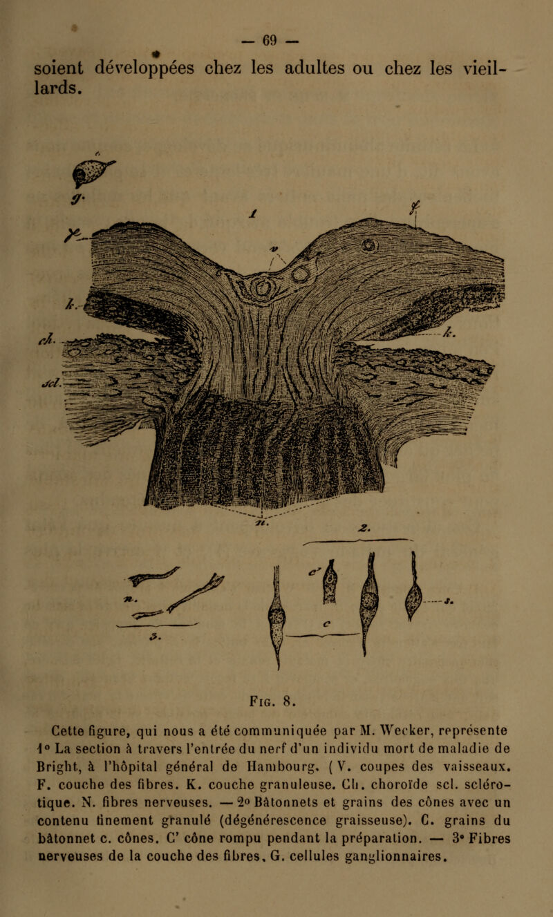 soient développées chez les adultes ou chez les vieil- lards. M-à Jcl. <jfSS&' Fig. 8. Cette figure, qui nous a été communiquée par M. Wecker, représente i° La section à travers l'entrée du nerf d'un individu mort de maladie de Bright, à l'hôpital général de Hambourg, ( V. coupes des vaisseaux. F. couche des fibres. K. couche granuleuse. Cli. choroïde sel. scléro- tique. N. fibres nerveuses. — 2° Bâtonnets et grains des cônes avec un contenu finement granulé (dégénérescence graisseuse). C. grains du bâtonnet c. cônes. C cône rompu pendant la préparation. — 3Q Fibres nerveuses de la couche des fibres, G. cellules ganglionnaires.