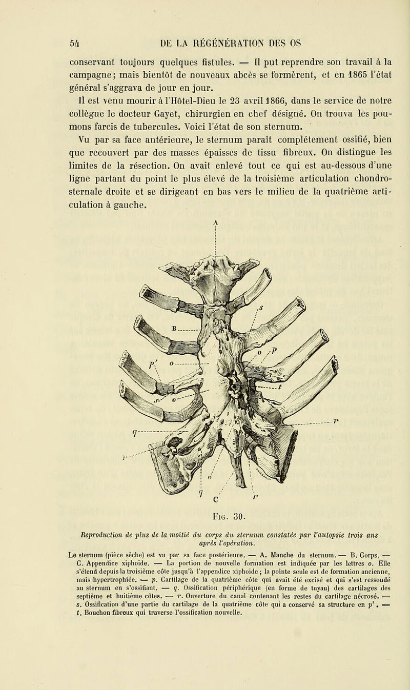 conservant toujours quelques fistules. — Il put reprendre son travail à la campagne; mais bientôt de nouveaux abcès se formèrent, et en 1865 l'état général s'aggrava de jour en jour. Il est venu mourir à l'Hôtel-Dieu le 23 avril 1866, dans le service de notre collègue le docteur Gayet, chirurgien en chef désigné. On trouva les pou- mons farcis de tubercules. Voici l'état de son sternum. Vu par sa face antérieure, le sternum paraît complètement ossifié, bien que recouvert par des masses épaisses de tissu fibreux. On distingue les limites de la résection. On avait enlevé tout ce qui est au-dessous d'une ligne partant du point le plus élevé de la troisième articulation chondro- sternale droite et se dirigeant en bas vers le milieu de la quatrième arti- culation à gauche. Fig. 30. Reproduction de plus de la moitié du corps du sternum constatée par l'autopsie trois ans après l'opération. Le sternum (pièce sèche) est vu par sa face postérieure. — A. Manche du sternum. — B. Corps. — C. Appendice xiphoïde. — La portion de nouvelle formation est indiquée par les lettres o. Elle s'étend depuis la troisième côte jusqu'à l'appendice xiphoïde ; la pointe seule est de formation ancienne, mais hypertrophiée. — p. Cartilage de la quatrième côte qui avait été excisé et qui s'est ressoudé au sternum en s'ossifiant. — q. Ossification périphérique (en forme de tuyau) des cartilages des septième et huitième côtes. — r. Ouverture du canal contenant les restes du cartilage nécrosé. — s. Ossification d'une partie du cartilage de la quatrième côte qui a conservé sa structure en p'. — t. Bouchon fibreux qui traverse l'ossification nouvelle.