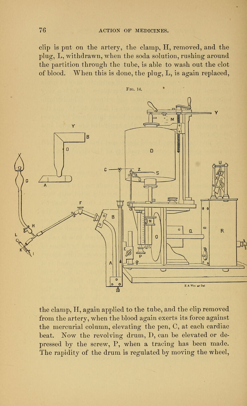 clip is put on the artery, the clamp, H, removed, and the plug, L, withdrawn, when the soda solution, rushing around the partition through the tube, is able to wash out the clot of blood. When this is done, the plug, L, is again replaced, Fig. 14. the clamp, H, again applied to the tube, and the clip removed from the artery, when the blood again exerts its force against the mercurial column, elevating the pen, C, at each cardiac beat. ISTow the revolving drum, I), can be elevated or de- pressed by the screw, P, when a tracing has been made. The rapidity of the drum is regulated by moving the wheel,